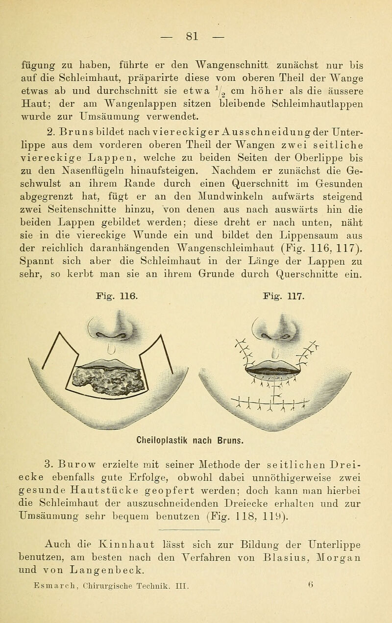 füguDg ZU haben, führte er den Wangenschnitt zunächst nur bis auf die Schleimhaut, präparirte diese vom oberen Theil der AYange etwas ab und durchschnitt sie etwa ^^ cm höher als die äussere Haut; der am Wangenlappen sitzen bleibende Schleimhautlappen wurde zur TJmsäumung verwendet. 2. Brunsbildet nach viereckiger Ausschneidungder Unter- lippe aus dem vorderen oberen Theil der Wangen zwei seitliche viereckige Lappen, welche zu beiden Seiten der Oberlippe bis zu den Xasenflügeln hinaufsteigen. Nachdem er zunächst die Ge- schwulst an ihrem Rande durch einen Querschnitt im Gesunden abgegrenzt hat, fügt er an den Mundwinkeln aufwärts steigend zwei Seitenschnitte hinzu, von denen aus nach auswärts hin die beiden Lappen gebildet werden; diese dreht er nach unten, näht sie in die viereckige Wunde ein und bildet den Lippensaum aus der reichlich daranhängenden Wangenschleimhaut (Fig. 116, 117). Spannt sich aber die Schleimhaut in der Länge der Lappen zu sehr, so kerbt man sie an ihrem Grunde durch Querschnitte ein. Fiff. 116. Fig. 117. Cheiloplastik nach Bruns. 3. Burow erzielte mit seiner Methode der seitlichen Drei- ecke ebenfalls gute Erfolge, obwohl dabei unnöthigerweise zwei gesunde Hautstücke geopfert werden; doch kann man hierbei die Schleimhaut der auszuschneidenden Dreiecke erhalten und zur Umsäumung sehr bequem benutzen (Fig. 118, lH-t)- Auch die Kinn haut lässt sich zur Bildung der Unterlippe benutzen, am besten nach den Verfahren von Blasius, Morgan und von Langenbeck. Esmarcli, Chirurgische Technik. III. 6