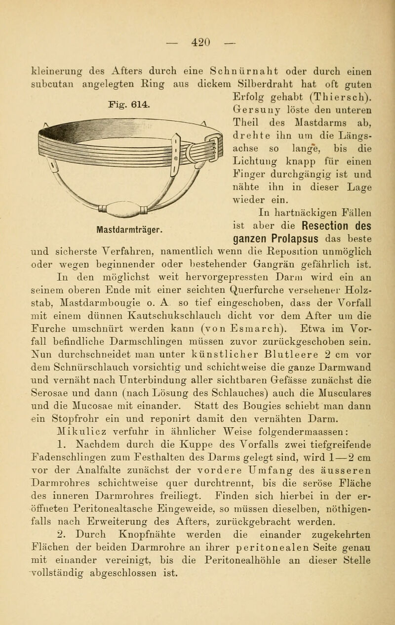 42ü Mastdarmträger. kleinerung des Afters durch eine Schnürnaht oder durch einen subcutan angelegten Ring aus dickem Silberdraht hat oft guten Erfolg gehabt (Thiersch). ^' ' Gersuny löste den unteren Theil des Mastdarms ab, drehte ihn um die Längs- achse so lang*e, bis die Lichtung knapp für einen Finger durchgängig ist und nähte ihn in dieser Lage wieder ein. In hartnäckigen Fällen ist aber die ResectJOn deS ganzen Prolapsus das beste und sicherste Verfahren, namentlich wenn die Reposition unmöglich oder Avegen beginnender oder bestehender Gangrän gefährlich ist. In den möglichst weit hervorgepressteu Dann wird ein an seinem oberen Ende mit einer seichten Querfurche versehener Holz- stab, Mastdarmbougie o. A so tief eingeschoben, dass der Vorfall mit einem dünnen Kautschukschlauch dicht vor dem After um die Furche umschnürt werden kann (von Esmarch). Etwa im Vor- fall befindliche Darmschlingen müssen zuvor zurückgeschoben sein. Xun durchschneidet man unter künstlicher Blutleere 2 cm vor dem Schnürschlauch vorsichtig und schichtweise die ganze Darmwand und vernäht nach Unterbindung aller sichtbaren Gefässe zunächst die Serosae und dann (nach Lösung des Schlauches) auch die Musculares und die Mucosae mit einander. Statt des Bougies schiebt man dann ein Stopfrohr ein und reponirt damit den vernähten Darm. Mikulicz verfuhr in ähnlicher Weise folgendermaassen: 1. Nachdem durch die Kuppe des Vorfalls zwei tiefgreifende Fadenschlingen zum Festhalten des Darms gelegt sind, wird 1 — 2 cm vor der Analfalte zunächst der vordere Umfang des äusseren Darmrohres schichtweise quer durchtrennt, bis die seröse Fläche des inneren Darmrohres freiliegt. Finden sich hierbei in der er- öffneten Peritonealtasche Eingeweide, so müssen dieselben, nöthigen- falls nach Erweiterung des Afters, zurückgebracht werden. 2. Durch Knopfnähte werden die einander zugekehrten Flächen der beiden Darmrohre an ihrer peritonealen Seite genau mit einander vereinigt, bis die Peritonealhöhle an dieser Stelle -vollständig abgeschlossen ist.