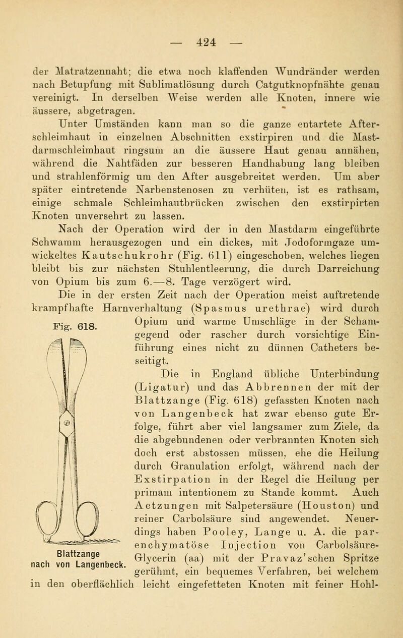 der Matratzennaht; die etwa noch klaffenden AVundränder werden nach Betupfung mit Sublimatlösung durch Catgutknopfnähte genau vereinigt. In derselben Weise werden alle Knoten, innei'e wie äussere, abgetragen. Unter Umständen kann man so die ganze entartete After- schleimhaut in einzelnen Abschnitten exstirpiren und die Mast- darmschleimhaut ringsum an die äussere Haut genau annähen, während die Nahtfäden zur besseren Handhabung lang bleiben und strahlenförmig um den After ausgebreitet werden. Um aber später eintretende Narbenstenosen zu vex'hüten, ist es rathsam, einige schmale Schleimhautbrücken zwischen den exstirpirten Knoten unversehrt zu lassen. Nach der Operation wird der in den Mastdarm eingeführte Schwamm herausgezogen und ein dickes, mit Jodoformgaze um- wickeltes Kautschukrohr (Fig. 611) eingeschoben, welches liegen bleibt bis zur nächsten Stuhlentleerung, die durch Darreichung von Opium bis zum 6.—8. Tage verzögei't wird. Die in der ersten Zeit nach der Operation meist auftretende krampfhafte Harnverhaltung (Spasmus urethrae) wird durch Fig. 618. Opium und warme Umschläge in der Scham- gegend oder rascher durch vorsichtige Ein- führung eines nicht zu dünnen Catheters be- seitigt. Die in England übliche Unterbindung (Ligatur) und das Abbrennen der mit der Blattzange (Fig. 618) gefassten Knoten nach von Langenbeck hat zwar ebenso gute Er- folge, führt aber viel langsamer zum Ziele, da die abgebundenen oder verbraunten Knoten sich doch erst abstossen müssen, ehe die Heilung durch Granulation erfolgt, während nach der Exstirpation in der Regel die Heilung per primam intentionem zu Stande kommt. Auch Aetzungen mit Salpetersäure (Houston) und reiner Carbolsäure sind angewendet. Neuer- dings haben Pooley, Lange u. A. die par- enchymatöse Injection von Carbolsäure- Glycerin (aa) mit der Pravaz'sehen Spritze gerühmt, ein bequemes Verfahren, bei welchem in den oberflächlich leicht eingefetteten Knoten mit feiner Hohl- Blattzange nach von Langenbeck.