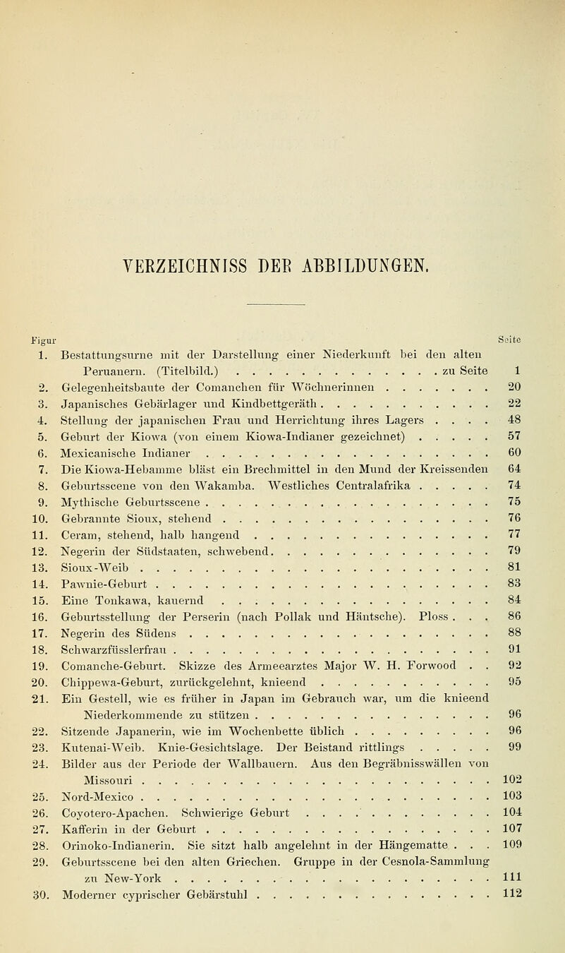 VERZEICHNISS DEE ABBILDUNGEN. Figur Seite 1. Bestattungsurne mit der Darstellung einer Niederkunft bei den alten Peruanern. (Titelbild.) zu Seite 1 2. Gelegenheitsbaute der Comanchen für Wöchnerinnen 20 3. Japanisches Gebärlager und Kindbettgeräth 22 4. Stellung der japanischen Frau und Herrichtung ihres Lagers .... 48 5. Gebiirt der Kiowa (von einem Kiowa-Indianer gezeichnet) 57 6. Mexicanische Indianer 60 7. Die Kiowa-Hebamme bläst ein Brechmittel in den Mund der Kreissenden 64 8. Geburtsscene von den Wakamba. Westliches Centralafrika 74 9. Mythische Geburtsscene 75 10. Gebrannte Sioux, stehend 76 11. Ceram, stehend, halb hangend 77 12. Negerin der Südstaaten, schwebend 79 13. Sioux-Weib ' 81 14. Pawnie-Geburt 83 15. Eine Tonkawa, kauernd 84 16. Geburtsstellung der Perserin (nach Pollak und Häntsche). Ploss ... 86 17. Negerin des Südens 88 18. Schwarzfüsslerfrau 91 19. Comanche-Geburt. Skizze des Armeearztes Major W. H. Porwood . . 92 20. Chippewa-Geburt, zurückgelehnt, knieend 95 21. Ein Gestell, wie es früher in Japan im Gebrauch war, um die knieend Niederkommende zu stützen 96 22. Sitzende Japanerin, wie im Wochenbette üblich 96 23. Kutenai-Weib. Knie-Gesichtslage. Der Beistand rittlings 99 24. Bilder aus der Periode der Wallbauern. Aus den Begräbnisswällen von Missouri 102 25. Nord-Mexico 103 26. Coyotero-Apachen. Schwierige Geburt . . . .' 104 27. Kafferin in der Geburt 107 28. Orinoko-Indianerin. Sie sitzt halb angelehnt in der Hängematte . . . 109 29. Geburtsscene bei den alten Griechen. Gruppe in der Cesnola-Sammlung zu New-York 111 30. Moderner cyprischer Gebärstuhl 112