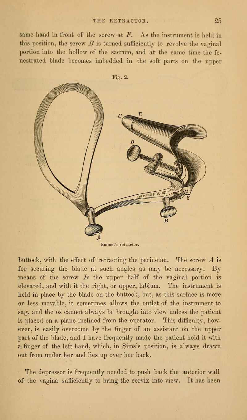 same hand in front of the screw at F. As the instrument is held in this position, the screw B is turned sufficiently to revolve the vaginal portion into the hollow of the sacrum, and at the same time the fe- nestrated blade becomes imbedded in the soft parts on the upper Fijr. 2. Emmet's retractor. buttock, with the effect of retracting the perineum. The screw A is for securing the blade at such angles as may be necessary. By means of the screw I) the upper half of the vaginal portion is elevated, and with it the right, or upper, labium. The instrument is held in place by the blade on the buttock, but, as this surface is more or less movable, it sometimes allows the outlet of the instrument to sag, and the os cannot always be brought into view unless the patient is placed on a plane inclined from the operator. This difficult}'-, how- ever, is easily overcome by the finger of an assistant on the upper part of the blade, and I have frequently made the patient hold it with a finger of the left hand, which, in Sims's position, is always drawn out from under her and lies up over her back. The depressor is frequently needed to push back the anterior wall of the vagina sufficiently to bring the cervix into view. It has been