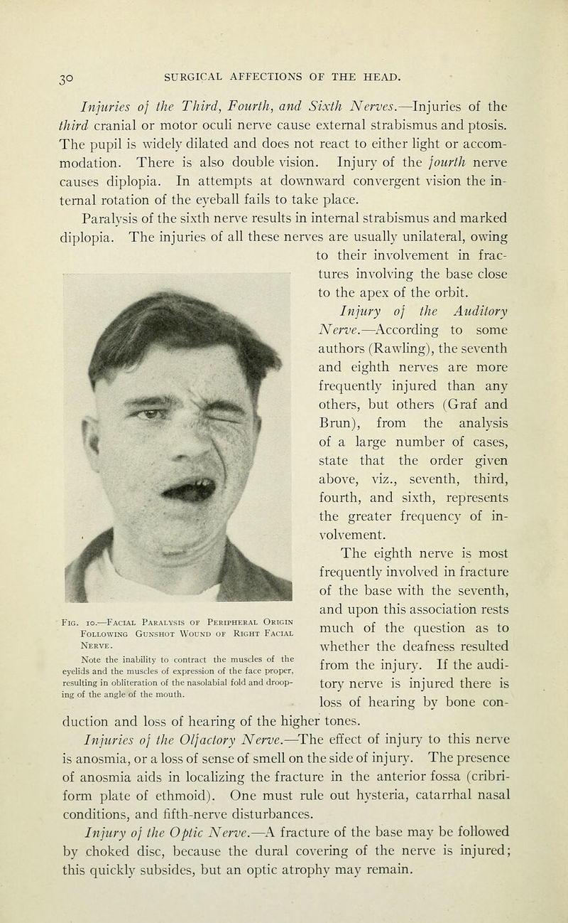 3° Injuries of the Third, Fourth, and Sixth Nerves.—Injuries of the third cranial or motor oculi nerve cause external strabismus and ptosis. The pupil is widely dilated and does not react to either hght or accom- modation. There is also double vision. Injury of the fourth nerve causes diplopia. In attempts at downward convergent vision the in- ternal rotation of the eyeball fails to take place. Paralysis of the sixth nerve results in internal strabismus and marked diplopia. The injuries of all these nerves are usually unilateral, owing to their involvement in frac- tures involving the base close to the apex of the orbit. Injury of the Auditory Nerve.—^According to some authors (Rawling), the seventh and eighth nen^es are more frequently injured than any others, but others (Graf and Brun), from the analysis of a large number of cases, state that the order given above, viz., seventh, third, fourth, and sixth, represents the greater frequency of in- . ^k . volvement. „^p\ * .^^ The eighth nen-e is most wK iH^^^^^ frequently involved in fracture ■^ ''^^^^^^^k of the base with the seventh, and upon this association rests much of the question as to whether the deafness resulted from the injury. If the audi- tory nerve is injured there is loss of hearing by bone con- duction and loss of hearing of the higher tones. Injuries of the Olfactory Nerve.—^The effect of injury to this nerve is anosmia, or a loss of sense of smell on the side of injury. The presence of anosmia aids in locahzing the fracture in the anterior fossa (cribri- form plate of ethmoid). One must rule out hysteria, catarrhal nasal conditions, and fifth-nerve disturbances. Injury of the Optic Nerve.—^A fracture of the base may be followed by choked disc, because the dural covering of the nerve is injured; this quickly subsides, but an optic atrophy may remain. Fig. 10.—Facial Paralysis of Peripheral Origin Following Gunshot Wound of Right Facial Nerve. Note the inability to contract the muscles of the eyelids and the muscles of expression of the face proper, resulting in obliteration of the nasolabial fold and droop- ing of the angle of the mouth.