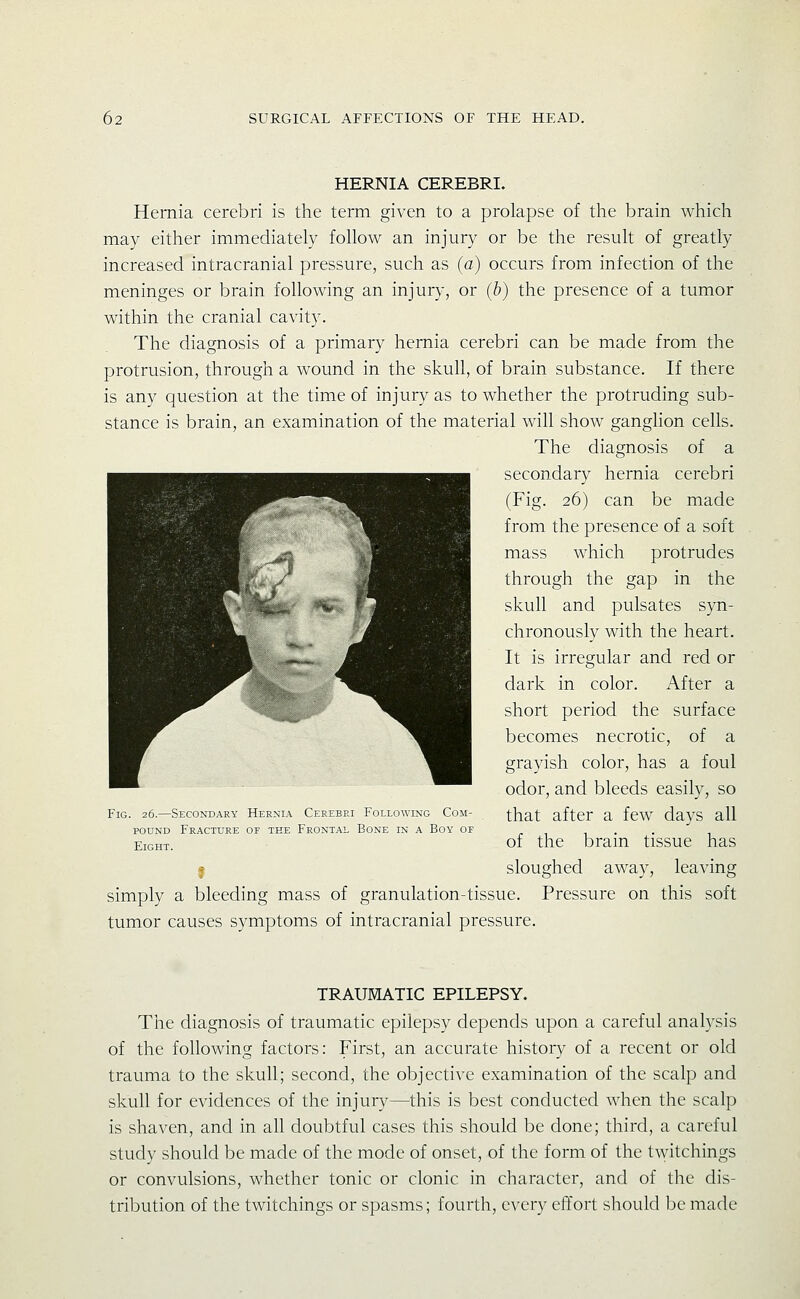 HERNIA CEREBRI. Hernia cerebri is the term given to a prolapse of the brain which may either immediately follow an injury or be the result of greatly increased intracranial pressure, such as (a) occurs from infection of the meninges or brain following an injury, or (b) the presence of a tumor within the cranial cavity. The diagnosis of a primary hernia cerebri can be made from the protrusion, through a wound in the skull, of brain substance. If there is any question at the time of injury as to whether the protruding sub- stance is brain, an examination of the material will show ganghon cells. The diagnosis of a secondary hernia cerebri (Fig. 26) can be made from the presence of a soft mass which protrudes through the gap in the skull and pulsates syn- chronously with the heart. It is irregular and red or dark in color. After a short period the surface becomes necrotic, of a grayish color, has a foul odor, and bleeds easily, so that after a few days all of the brain tissue has • sloughed away, leaving simply a bleeding mass of granulation-tissue. Pressure on this soft tumor causes symptoms of intracranial pressure. Fig. 26.—Secondary Hernia Cerebri Following Com- pound Fracture of the Frontal Bone in a Boy of Eight. TRAUMATIC EPILEPSY. The diagnosis of traumatic epilepsy depends upon a careful analysis of the following factors: First, an accurate history of a recent or old trauma to the skull; second, the objective examination of the scalp and skull for evidences of the injury—this is best conducted when the scalp is shaven, and in all doubtful cases this should be done; third, a careful study should be made of the mode of onset, of the form of the t\vitchings or convulsions, whether tonic or clonic in character, and of the dis- tribution of the twitchings or spasms; fourth, every effort should ])C made