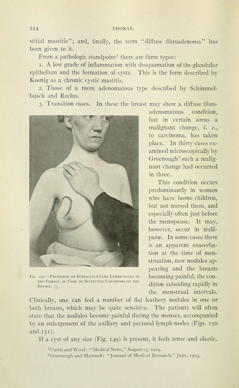 stitial mastitis; and, finally, the term diffuse fibroadenoma has been given to it. From a pathologic standpoint^ there are three types: 1. A low grade of inflammation T\ath desquamation of the glandular epitheHum and the formation of cysts. This is the form described by Koenig as a chronic cystic mastitis. 2. Those of a more adenomatous t}'pe described by Schimmel- busch and Reclus. 3. Transition cases. In these the breast may show a diftuse fibro- adenomatous condition, but in certain areas a malignant change, i. e., to carcinoma, has taken place. In thirty cases ex- amined microscopically by Greenough^ such a malig- nant change had occurred in three. This condition occurs predominantly in women who have borne children, but not nursed them, and especially often just before the menopause. It may, however, occur in nulli- parae. In some cases there is an apparent exacerba- tion at the time of men- struation, new nodules ap- pearing and the breasts Fig. 150—Palpation of Supraclavicular Lymph-nodes es? bcCOming painful, the COn- THE Female, in Case of Suspected Carcinoma of the ,.,. i • t • n B^j,As.j._ dition subsidmg rapidly m the menstrual inter^-als. Clinically, one can feel a number of flat leathery nodules in one or both breasts, which may be quite sensitive. The patients will often state that the nodules become painful during the menses, accompanied by an enlargement of the axillary and pectoral lymph-nodes (Figs. 150 and 151). If a cyst of any size (Fig. 149) is present, it feels tense and elastic. ' Curtis and Wood: ^Medical News, August 13, 1904. ^Greenough and Hartwell: Journal of Medical Research, June, 1903.