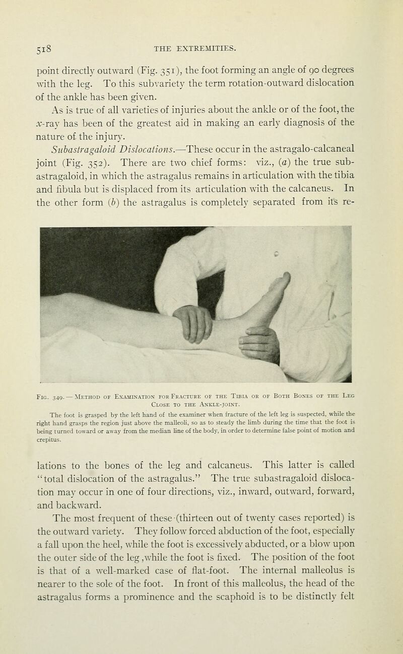 point directly outward (Fig. 351), the foot forming an angle of 90 degrees with the leg. To this subvariety the term rotation-outward dislocation of the ankle has been given. As is true of all varieties of injuries about the ankle or of the foot, the :v-ray has been of the greatest aid in making an early diagnosis of the nature of the injury. Suhastragaloid Dislocations.—These occur in the astragalo-calcaneal joint (Fig. 352). There are two chief forms: \iz., {a) the true suh- astragaloid, in which the astragalus remains in articulation with the tibia and fibula but is displaced from its articulation with the calcaneus. In the other form ih) the astragalus is completely separated from its re- FiG. 349. — Method of Ex.-iiiiNATiON for Fracture of the Tibl\ or of Both Bones of the Leg Close to the Ankle-joint. The foot is grasped by the left hand of the examiner when fracture of the left leg is suspected, while the right hand grasps the region just above the malleoli, so as to steady the limb during the time that the foot is being tiurned toward or away from the median line of the body, in order to determine false point of motion and crepitus. lations to the bones of the leg and calcaneus. This latter is called total dislocation of the astragalus. The true suhastragaloid disloca- tion may occur in one of four directions, viz., inward, outward, forward, and backward. The most frequent of these-(thirteen out of twenty cases reported) is the outward variety. They follow forced abduction of the foot, especially a fall upon the heel, while the foot is excessively abducted, or a blow upon the outer side of the leg ,while the foot is fixed. The position of the foot is that of a well-marked case of flat-foot. The internal malleolus is nearer to the sole of the foot. In front of this malleolus, the head of the astragalus forms a prominence and the scaphoid is to be distinctly felt