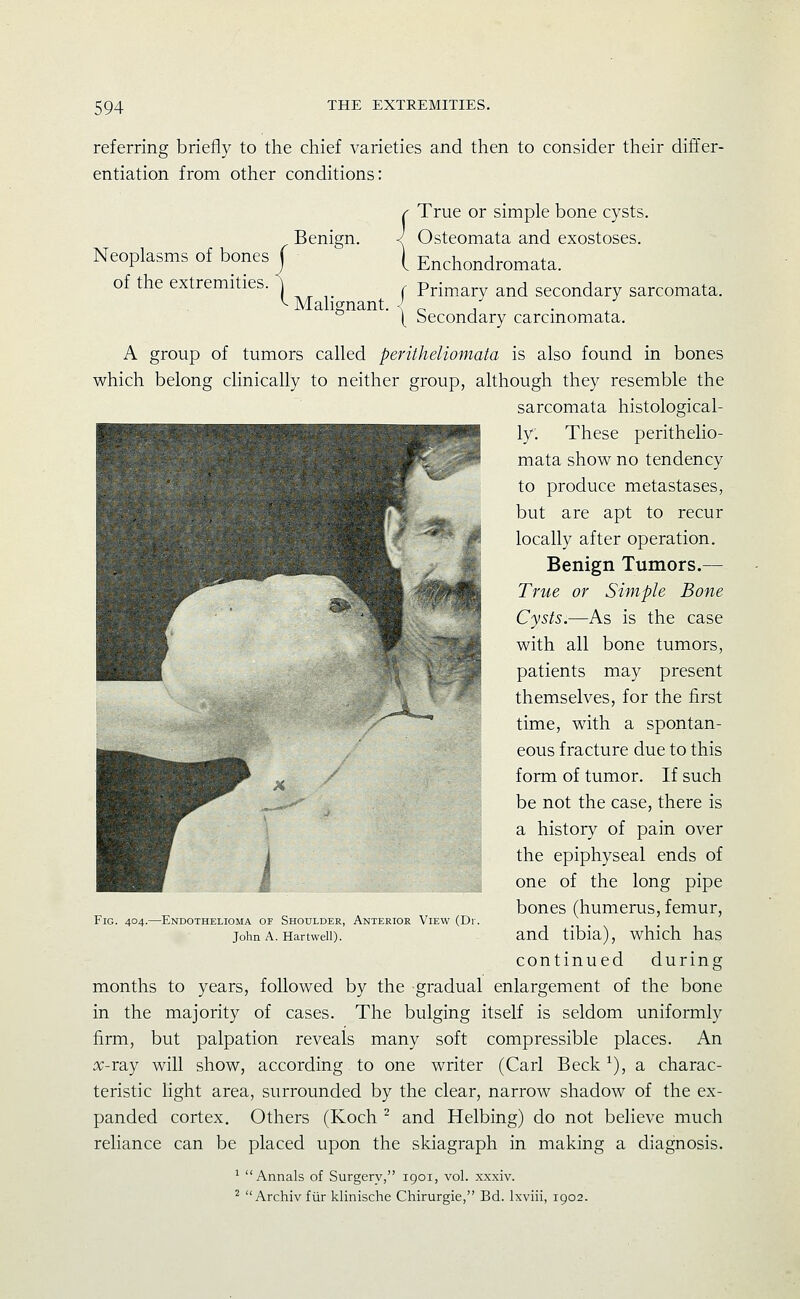 referring briefly to the chief varieties and then to consider their differ- entiation from other conditions: Benign. Neoplasms of bones j of the extremities. ] '^ Mahgnant. {True or simple bone cysts. Osteomata and exostoses. Enchondromata. f Primary and secondary sarcomata. \ Secondary carcinomata. A group of tumors called peritheliomata is also found in bones which belong clinically to neither group, although they resemble the sarcomata histological- ly. These perithelio- mata show no tendency to produce metastases, but are apt to recur locally after operation. Benign Tumors.— True or Simple Bone Cysts.—As is the case with all bone tumors, patients may present themselves, for the first time, with a spontan- eous fracture due to this form of tumor. If such be not the case, there is a history of pain over the epiphyseal ends of one of the long pipe bones (humerus, femur, and tibia), which has continued during months to years, followed by the gradual enlargement of the bone in the majority of cases. The bulging itself is seldom uniformly firm, but palpation reveals many soft compressible places. An x-ray will show, according to one writer (Carl Beck ^), a charac- teristic light area, surrounded by the clear, narrow shadow of the ex- panded cortex. Others (Koch ^ and Helbing) do not believe much reliance can be placed upon the skiagraph in making a diagnosis. ^ Annals of Surgery, 1901, vol. xxxiv. ^  Archiv fur klinische Chirurgie, Bd. Ixviii, 1902. Fig. 404.—Endothelioma of Shoulder, Anterior View (Dr. John A. Hartwell).