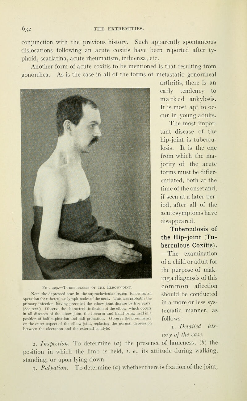 conjunction with the previous histor}^ Such apparently spontaneous dislocations following an acute coxitis have been reported after ty- phoid, scarlatina, acute rheumatism, influenza, etc. Another form of acute coxitis to be mentioned is that resulting from gonorrhea. As is the case in all of the forms of metastatic gonorrheal arthritis, there is an early tendency to marked ankylosis. It is most apt to oc- cur in young adults. The most impor- tant disease of the hip-joint is tubercu- losis. It is the one from which the ma- jority of the acute forms must be differ- entiated, both at the time of the onset and, if seen at a later per- iod, after all of the acute symptoms have disappeared. Tuberculosis of the Hip-joint (Tu- berculous Coxitis). —The examination of a child or adult for the purpose of mak- ing a diagnosis of this common affection should be conducted in a more or less sys- tematic manner, as follows: I. Detailed his- tory of the case. 2. Inspection. To determine (a) the presence of lameness; (b) the position in which the hmb is held, /. e., its attitude during walking, standing, or upon lying down. 3. Palpation. To determine (a) whether there is fixation of the joint, Fig. 429.—Tuberculosis of the Elbow-joint. Note the depressed scar in the supraclavicular region following an operation for tuberculous lymph-nodes of the neck. This was probably the primary infection, having preceded the elbow-joint disease by five years. (See text.) Observe the characteristic fle.xion of the elbow, which occurs in all diseases of the elbow-joint, the forearm and hand being held in a position of half supination and half pronation. Observe the prominence on the outer aspect of the elbow-joint, replacing the normal depression between the olecranon and the e.xternal condyle: