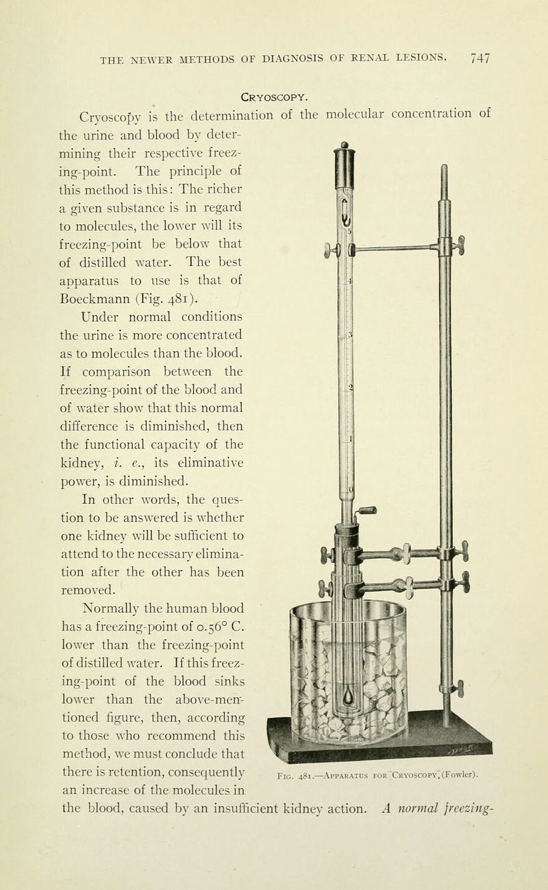 Cryoscopy. Crvoscopy is the determination of tlie molecular concentration of the urine and blood by deter- mining their respective freez- ing-point. The principle of this method is this: The richer a given substance is in regard to molecules, the lower will its freezing-point be below that of distilled water. The best apparatus to use is that of Boeckmann (Fig. 481). Under normal conditions the urine is more concentrated as to molecules than the blood. If comparison between the freezing-point of the blood and of water show that this normal difference is diminished, then the functional capacity of the kidney, i. e., its eliminative power, is diminished. In other words, the ques- tion to be answered is whether one kidney will be sufficient to attend to the necessary elimina- tion after the other has been removed. Normally the human blood has a freezing-point of 0.56° C. lower than the freezing-point of distilled water. If this freez- ing-point of the blood sinks lower than the above-men'- tioned figure, then, according to those who recommend this method, we must conclude that there is retention, consequently pic. 481.-apparatus for ;cRvoscopY:(Fowier). an increase of the molecules in the blood, caused by an insufficient kidney action. A normal freezing-