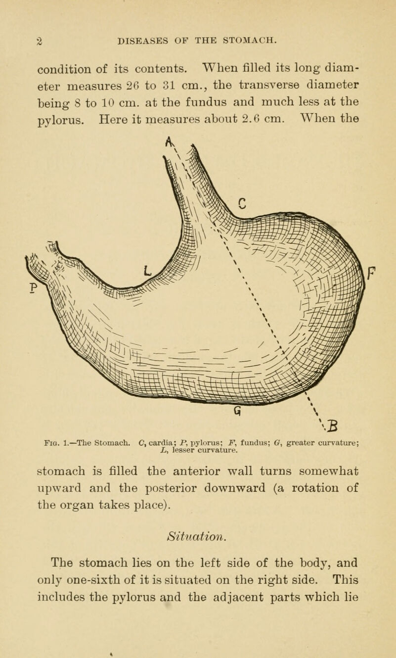 condition of its contents. When filled its long diam- eter measures 20 to 31 cm., the transverse diameter being 8 to 10 cm. at the fundus and much less at the pylorus. Here it measures about 2.6 cm. When the FiQ. 1.—The Stomach. C, cardia; P, pylorus; F, fundus; G, greater curvature; L, lesser curvature. stomach is filled the anterior wall turns somewhat upward and the posterior downward (a rotation of the organ takes place). Situation. The stomach lies on the left side of the body, and only one-sixth of it is situated on the right side. This includes the pylorus and the adjacent parts which lie