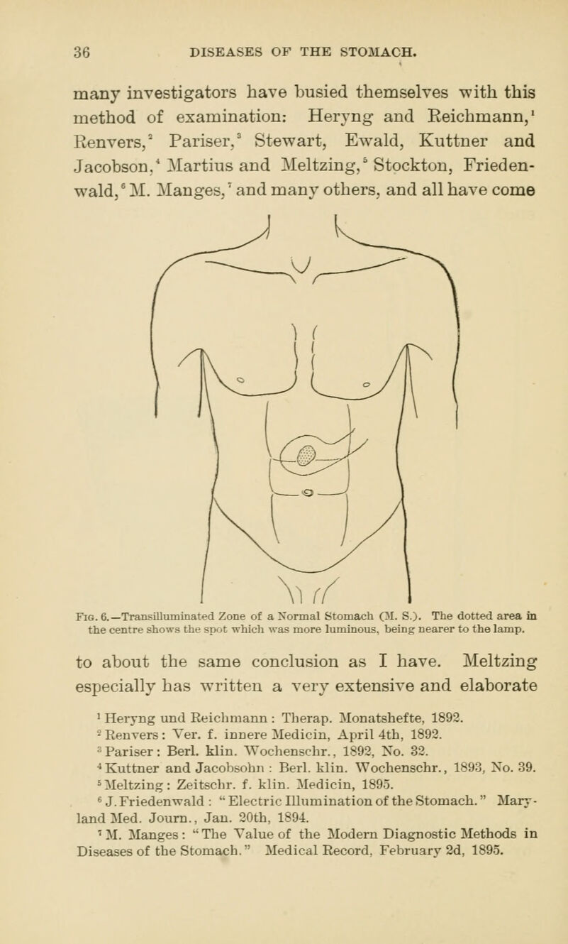 many investigators have busied themselves vrith this method of examination: Heryng and Eeichmann,' Renvers,* Pariser/ Stewart, Ewald, Kuttner and Jacobson.* Martins and Meltzing, Stockton, Frieden- wald,^ M. Manges,' and many others, and all have come Fig. 6.—Transilluminated Zone of a Normal Stomach (51. S.). The dotted area in the centre shows the spot which was more luminous, being nearer to the lamp. to about the same conclusion as I have. Meltzing especially has written a very extensive and elaborate ' Heryng und Reichmann : Therap. Monatshefte, 1892. ^Renvers: Ver. f. innere Medicin, April 4th, 1892. sPariser: Berl. klin. AVochenschr., 1892, No. 32. ■•Kuttner and Jacobsohn : Berl. klin. Wochenschr., 1893, No. 39. ^Meltzing: Zeitschr. f. klin. Medicin, 1895. «J. Friedenwald :  Electric Illumination of the Stomach. Mary- land Med. Joum., Jan. 20th, 1894. ' M. Manges :  The Value of the Modem Diagnostic Methods in Diseases of the Stomach.' Medical Record, Februarj'2d, 1895.