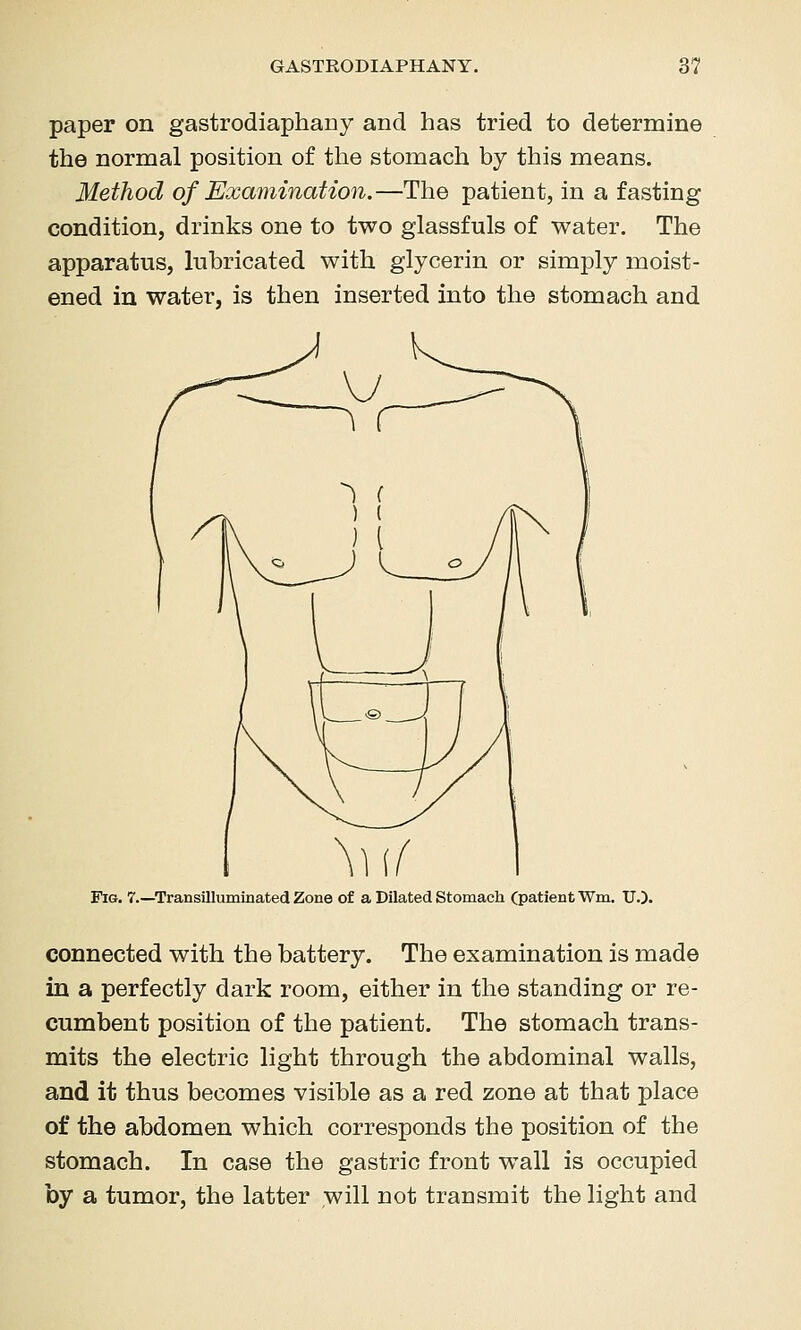 paper on gastrodiaphany and has tried to determine the normal position of the stomach by this means. Method of Examination.—The patient, in a fasting condition, drinks one to two glassfuls of water. The apparatus, lubricated with glycerin or simply moist- ened in water, is then inserted into the stomach and Fig. 7.—^Transilluminated Zone of a Dilated Stomach (patient Wm. U.). connected with the battery. The examination is made in a perfectly dark room, either in the standing or re- cumbent position of the patient. The stomach trans- mits the electric light through the abdominal walls, and it thus becomes visible as a red zone at that place of the abdomen which corresponds the position of the stomach. In case the gastric front wall is occupied by a tumor, the latter will not transmit the light and