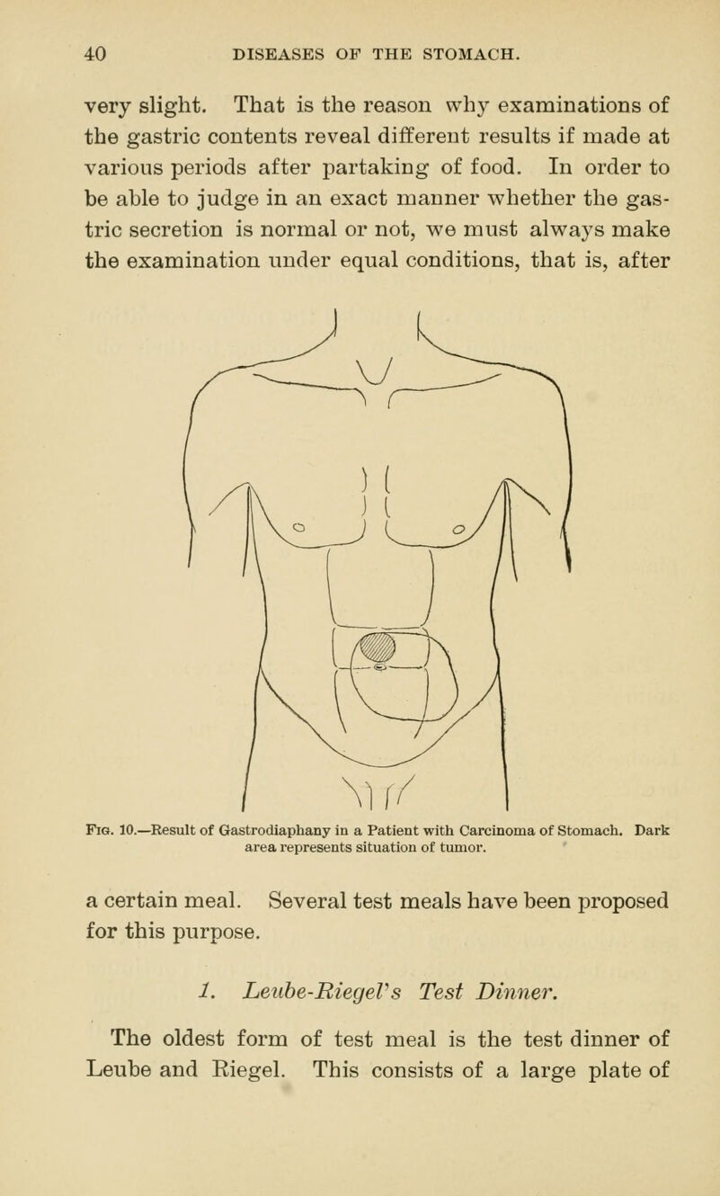 very slight. That is the reason why examinations of the gastric contents reveal different results if made at various periods after partaking of food. In order to be able to judge in an exact manner whether the gas- tric secretion is normal or not, we must always make the examination under equal conditions, that is, after Fig. 10.—Result of Gastrodiaphany in a Patient with Carcinoma of Stomach. Dark area represents situation of tumor. a certain meal. Several test meals have been proposed for this purpose. 1. Leuhe-BiegeVs Test Dinner. The oldest form of test meal is the test dinner of Leube and Eiegel. This consists of a large plate of