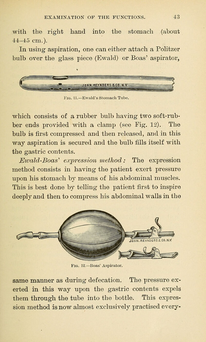 with the right hand into the stomach (about 44-4:5 cm.). In using aspiration, one can either attach a Politzer bulb over the glass piece (Ewald) or Boas' aspirator, Fig. 11.—Ewald's Stomach Tube. which consists of a rubber bulb having two soft-rub- ber ends provided with a clamp (see Fig. 12). The bulb is first compressed and then released, and in this way aspiration is secured and the bulb fills itself with the gastric contents. Ewalcl-Boas'' expression method: The expression method consists in having the patient exert pressure upon his stomach by means of his abdominal muscles. This is best done by telling the patient first to inspire deeply and then to compress his abdominal walls in the Fig. 13.—Boas' Aspirator. same manner as during defecation. The pressure ex- erted in this way upon the gastric contents expels them through the tube into the bottle. This expres- sion method is now almost exclusively practised every-