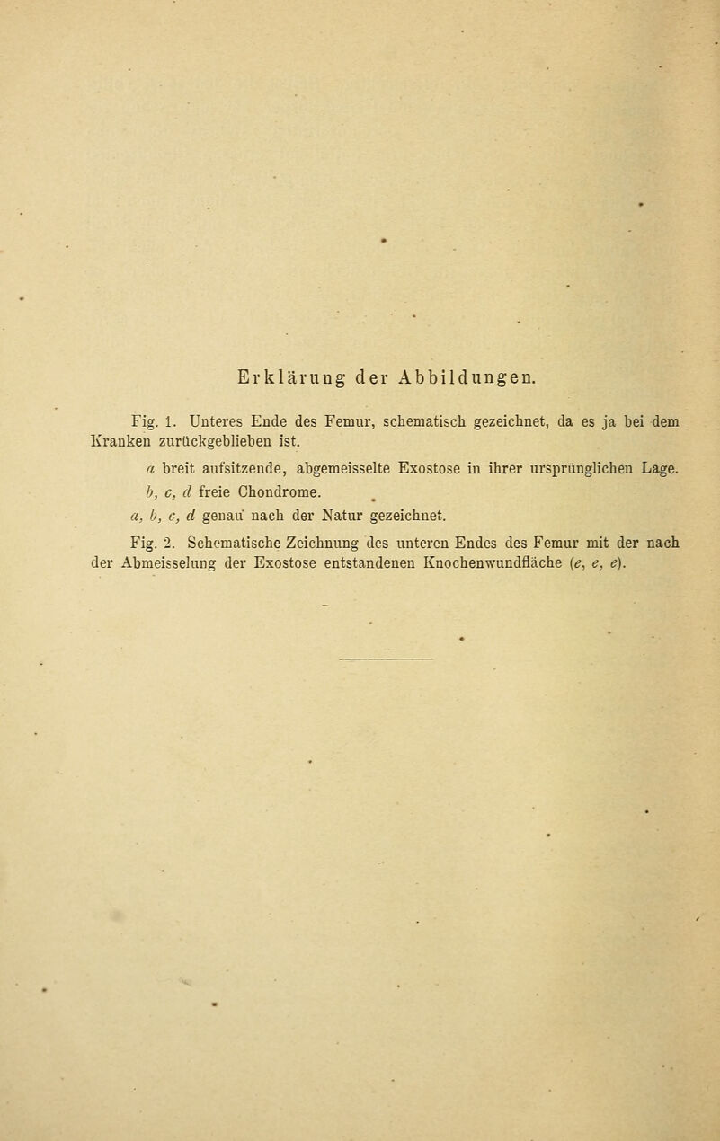 Erklärung der Abbildungen. Fig. 1. Unteres Ende des Femur, schematisch gezeichnet, da es ja bei dem Kranken zurückgeblieben ist. a breit aufsitzende, abgemeisselte Exostose in ihrer ursprünglichen Lage. h, c, d freie Chondrome. a, b, c, d genau nach der Natur gezeichnet. Fig. 2. Schematische Zeichnung des unteren Endes des Femur mit der nach der Abmeisselung der Exostose entstandenen Knochenwundfläche [e, e, e).