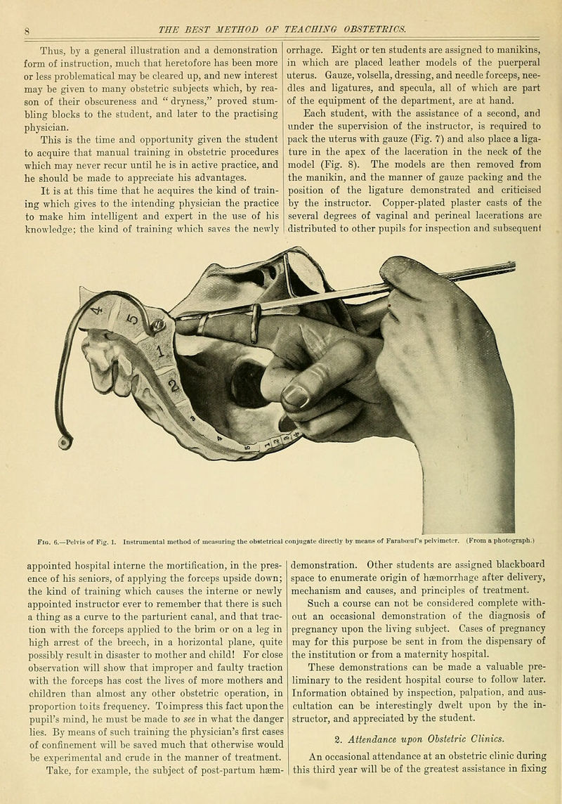 Thus, by a general illustration and a demonstration form of instruction, much that heretofore has been more or less problematical may be cleared up, and new interest may be given to many obstetric subjects which, by rea- son of their obsoureness and dryness, proved stum- bling blocks to the student, and later to the practising physician. This is the time and opportunity given the student to acquire that manual training in obstetric procedures which may never recur until he is in active practice, and he should be made to appreciate his advantages. It is at this time that he acquires the kind of train- ing which gives to the intending physician the practice to make him intelligent and expert in the use of his knowledge; the kind of training which saves the newly orrhage. Eight or ten students are assigned to manikins, in which are placed leather models of the puerperal uterus. Gauze, volsella, dressing, and needle forceps, nee- dles and ligatures, and specula, all of which are part of the equipment of the department, are at hand. Each student, with the assistance of a second, and under the supervision of the instructor, is required to pack the uterus with gauze (Fig. 7) and also place a liga- ture in the apex of the laceration in the neck of the model (Fig. 8). The models are then removed from the manildn, and the manner of gauze packing and the position of the ligature demonstrated and criticised by the instructor. Copper-plated plaster casts of the several degrees of vaginal and perineal lacerations are distributed to other pupils for inspection and subsequent Flo. 6.—PelviB of Fig. 1. Instrumental method of measuring tlie obstetrical conjugate directly by of Faraba?uf'8 pelvimeter. appointed hospital interne the mortification, in the pres- ence of his seniors, of applying the forceps upside down; the kind of training which causes the interne or newly appointed instructor ever to remember that there is such a thing as a curve to the parturient canal, and that trac- tion with the forceps applied to the brim or on a leg in high arrest of the breech, in a horizontal plane, quite possibly result in disaster to mother and child! For close observation will show that improper and faulty traction with the forceps has cost the lives of more mothers and children than almost any other obstetric operation, in proportion toils frequency. To impress this fact upon the pupil's mind, he must be made to see in what the danger lies. By means of such training the physician's first cases of confinement will be saved much that otherwise would be experimental and crude in the manner of treatment. Take, for example, the subject of post-partum haem- demonstration. Other students are assigned blackboard space to enumerate origin of hfemorrhage after delivery, mechanism and causes, and principles of treatment. Such a course can not be considered complete with- out an occasional demonstration of the diagnosis of pregnancy upon the living subject. Cases of pregnancy may for this purpose be sent in from the dispensary of the institution or from a maternity hospital. These demonstrations can be made a valuable pre- liminary to the resident hospital course to follow later. Information obtained by inspection, palpation, and aus- cultation can be interestingly dwelt upon by the in- structor, and appreciated by the student. 2. Attendance upon Oistetric Clinics. An occasional attendance at an obstetric clinic during this third year will be of the greatest assistance in fixing