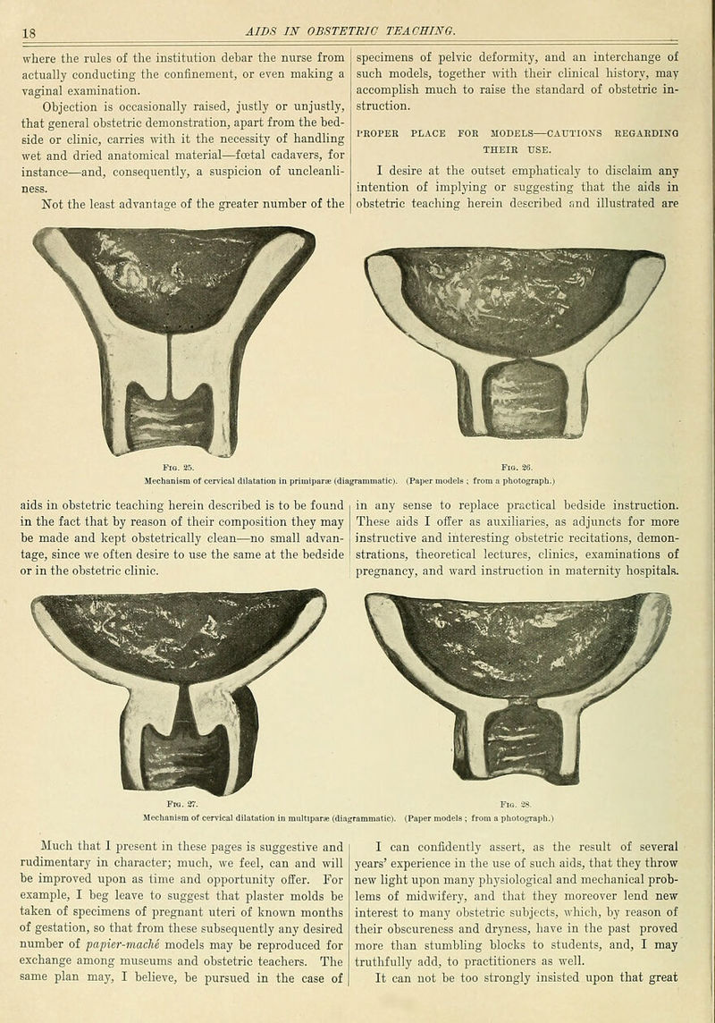 where the rules of the institution debar the nurse from actually conducting the confinement, or even making a vaginal examination. Objection is occasionally raised, justly or unjustly, that general obstetric demonstration, apart from the bed- side or clinic, carries with it the necessity of handling wet and dried anatomical material—fcetal cadavers, for instance—and, consequently, a suspicion of uncleanli- ness. Not the least advantage of the greater number of the specimens of pelvic deformity, and an interchange of such models, together with their clinical history, may accomplish much to raise the standard of obstetric in- struction. I'ROPEE PLACE FOE MODELS CAUTIONS EEGAEDINQ THEIE USE. I desire at the outset emphaticaly to disclaim any intention of impljdng or suggesting that the aids in obstetric teaching herein described and illustrated are Fig. 25. Mechaniem of cervical dilatation i primiparee (diagrammatic). (Paper models ; from a photograph.) aids in obstetric teaching herein described is to be found in the fact that by reason of their composition they may be made and kept obstetrically clean—no small advan- tage, since we often desire to use the same at the bedside or in the obstetric clinic. in any sense to replace practical bedside instruction. These aids I offer as auxiliaries, as adjuncts for more instructive and interesting obstetric recitations, demon- strations, theoretical lectures, clinics, examinations of pregnancy, and ward instruction in maternity hospitals. Mechanism of cervical dilatation i Fig. S8. mltlparae (diagrammatic). (Paper models ; from a photograph.) Much that I present in these pages is suggestive and rudimentary in character; much, we feel, can and will be improved upon as time and opportunity ofEer. For example, I beg leave to suggest that plaster molds be taken of specimens of pregnant uteri of known months of gestation, so that from these subsequently any desired number of papier-mache models may be reproduced for exchange among museums and obstetric teachers. The same plan may, I believe, be pursued in the case of I can confidently assert, as the result of several years' experience in the use of such aids, that they throw new light upon many physiological and mechanical prob- lems of midwifery, and that they moreover lend new interest to many obstetric subjects, which, by reason of their obscureness and dryness, have in the past proved more than stumbling blocks to students, and, I may truthfully add, to practitioners as well. It can not be too strongly insisted upon that great