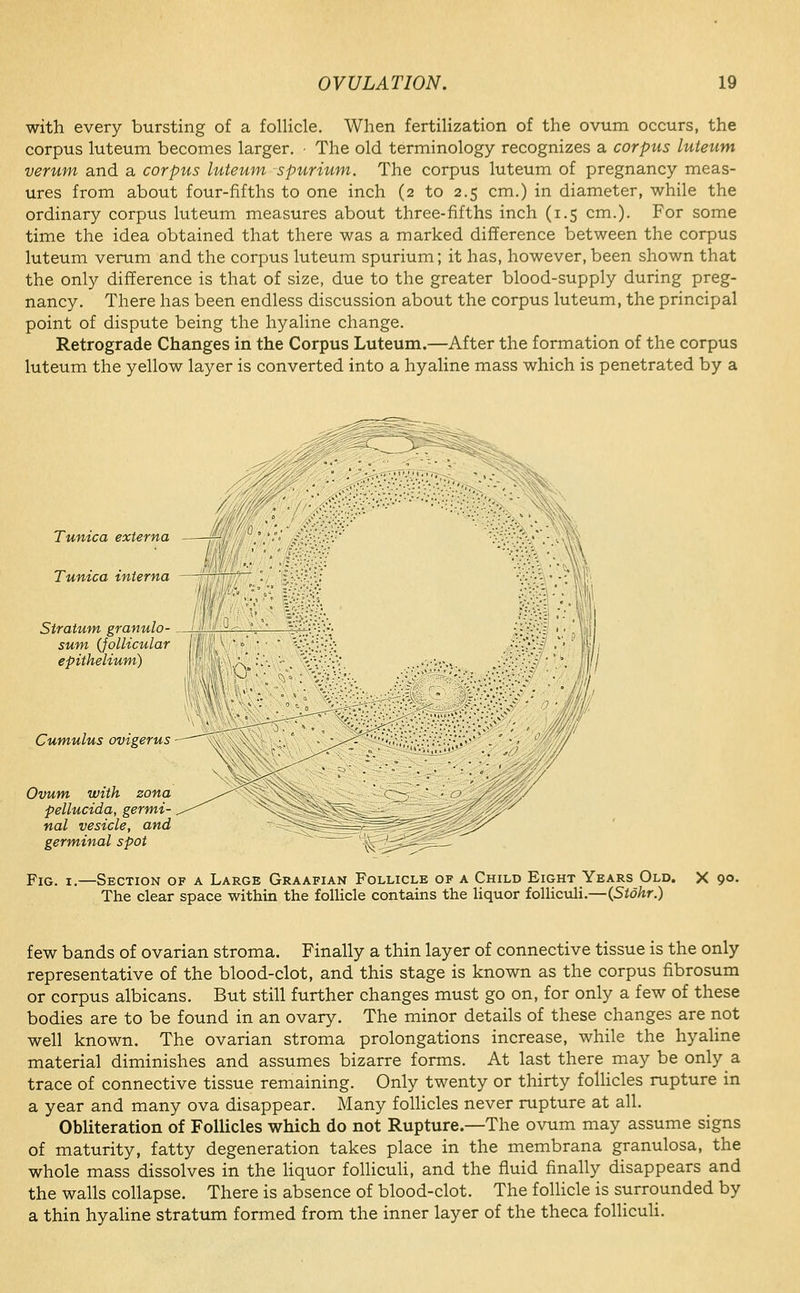 with every bursting of a follicle. When fertilization of the ovum occurs, the corpus luteum becomes larger. ■ The old terminology recognizes a corpus luteum verum and a corpus luteum spurium. The corpus luteum of pregnancy meas- ures from about four-fifths to one inch (2 to 2.5 cm.) in diameter, while the ordinary corpus luteum measures about three-fifths inch (1.5 cm.). For some time the idea obtained that there was a marked difference between the corpus luteum verum and the corpus luteum spurium; it has, however,been shown that the only difference is that of size, due to the greater blood-supply during preg- nancy. There has been endless discussion about the corpus luteum, the principal point of dispute being the hyaline change. Retrograde Changes in the Corpus Luteum.—After the formation of the corpus luteum the yellow layer is converted into a hyaline mass which is penetrated by a Tunica externa Tunica interna Stratum granulo- sum (follicular epithelium) Cumulus ovigerus Ovum with zona pellucida, germi- nal vesicle, and germinal spot Fig. I.—Section of a Large Graafian Follicle of a Child Eight Years Old. X 9°- The clear space within the follicle contains the liquor follictdi.—(Stohr.) few bands of ovarian stroma. Finally a thin layer of connective tissue is the only representative of the blood-clot, and this stage is known as the corpus fibrosum or corpus albicans. But still further changes must go on, for only a few of these bodies are to be found in an ovary. The minor details of these changes are not well known. The ovarian stroma prolongations increase, while the hyahne material diminishes and assumes bizarre forms. At last there may be only a trace of connective tissue remaining. Only twenty or thirty folhcles rupture in a year and many ova disappear. Many folhcles never rupture at all. Obliteration of Follicles which do not Rupture.—The ovum may assume signs of maturity, fatty degeneration takes place in the membrana granulosa, the whole mass dissolves in the hquor follicuH, and the fluid finally disappears and the walls collapse. There is absence of blood-clot. The foUicle is surrounded by a thin hyaline stratum formed from the inner layer of the theca foUiculi.