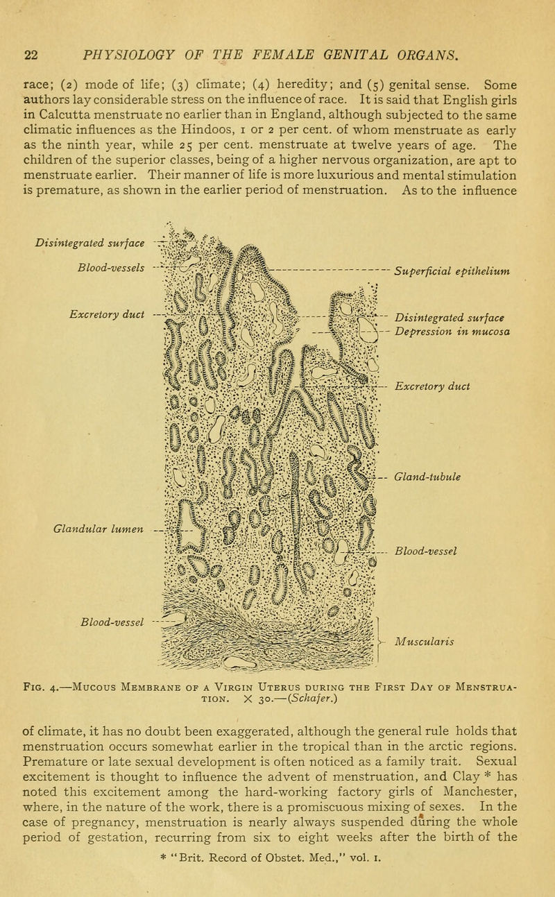 race; (2) mode of life; (3) climate; (4) heredity; and (5) genital sense. Some authors lay considerable stress on the influence of race. It is said that English girls in Calcutta menstruate no earlier than in England, although subjected to the same climatic influences as the Hindoos, i or 2 per cent, of whom menstruate as early as the ninth year, while 25 per cent, menstruate at twelve years of age. The children of the superior classes, being of a higher nervous organization, are apt to menstruate earlier. Their manner of life is more luxurious and mental stimulation is premature, as shown in the earlier period of menstruation. As to the influence Disintegrated surface :T..pji^~,Jy'.->f'^. Blood-vessels ■ -'.'j?x>^s^V fe^: Excretory duct ._J:?Mv'S^I Superficial epithelium Disintegrated surface Glandular lumen ^■^C'-;{■■.U/^'^ —^P'Kit J— Depression in mucosa '^^y^\-^^,':^lf?^'':J.':ll':M■S^-^^'^'^-^A%''^-^^^— Excretory duct •- Gland-tubule Blood-vessel Blood-vessel >-- Muscularis Fig. 4.—Mucous Membrane of a Virgin Uterus during the First Day of Menstrua- tion. X 30.—(Schafer.) of climate, it has no doubt been exaggerated, although the general rule holds that menstruation occurs somewhat earlier in the tropical than in the arctic regions. Premature or late sexual development is often noticed as a family trait. Sexual excitement is thought to influence the advent of menstruation, and Clay * has noted this excitement among the hard-working factory girls of Manchester, where, in the nature of the work, there is a promiscuous mixing of sexes. In the case of pregnancy, menstruation is nearly always suspended during the whole period of gestation, recurring from six to eight weeks after the birth of the * Brit. Record of Obstet. Med., vol. i.