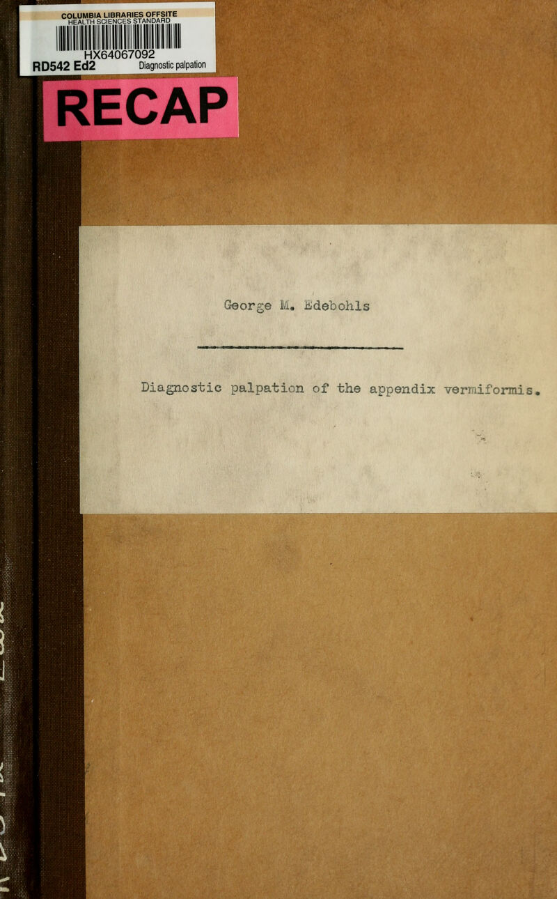 COLUMBIA LIBRARIES OFFSITE HEALTH SCIENCES STANDARD HX64067092 RD542 Ed2 Diagnostic palpation RECAP George M. Jidebohls Diagnostic palpation of the appendix vermiformis,