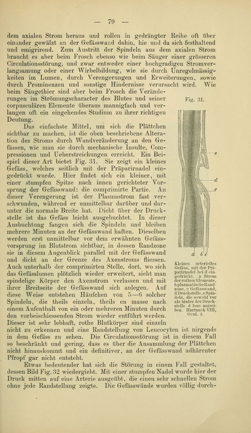 Fiff. 31. dem axialen Strom heraus und rollen in gedrängter Reihe oft über einander gewälzt an der Gefässwand dahin, hie und da sich festhaltend und emigrirend. Zum Austritt der Spindeln aus dem axialen Strom braucht es aber beim Frosch ebenso wie beim Säuger einer grösseren Circulationsstörung, und zwar entweder einer hochgradigen Stromver- langsamung oder einer Wirbelbildung, wie sie durch Unregelmässig- keiten im Lumen, durch Verengerungen und Erweiterungen, sowie durch Prominenzen und sonstige Hindernisse verursacht wird. Wie beim Säugethier sind aber beim Frosch die Verände- rungen im Strömungscharacter des Blutes und seiner corpusculären Elemente überaus mannigfach und ver- langen oft ein eingehendes Studium zu ihrer richtigen Deutung. Das einfachste Mittel, um sich die Plättchen sichtbar zu machen, ist die oben beschriebene Altera- tion des Stroms durch Wandveränderung an den Ge- fässen, wie man sie durch mechanische Insulte, Com- pressionen und Ueberstreichungen erreicht. Ein Bei- spiel dieser Art bietet Fig. 31. Sie zeigt ein kleines Gefäss, welches seitlich mit der Präparirnadel ein- gedrückt wurde. Hier findet sich ein kleiner, mit einer stumpfen Spitze nach innen gerichteter Vor- sprung der Gefässwand: die comprimirte Partie. An dieser Verengerung ist der Plasmastrom fast ver- schwunden, während er unmittelbar darüber und dar- unter die normale Breite hat. Dicht über der Druck- stelle ist das Gefäss leicht ausgebuchtet. In dieser Ausbuchtung fangen sich die Spindeln und bleiben mehrere Minuten an der Gefässwand haften. Dieselben werden erst unmittelbar vor dem erwähnten Gefäss- vorsprung im Blutstrom sichtbar, in dessen Randzone sie in diesem Augenblick parallel mit der Gefässwand und dicht an der Grenze des Axenstroms fliessen. Auch unterhalb der comprimirten Stelle, dort, wo sich das Gefässlumen plötzlich wieder erweitert, sieht man spindelige Körper den Axenstrom verlassen und mit ihrer Breitseite der Gefässwand sich anlegen. Auf diese Weise entstehen Häufchen von 5—6 solcher Spindeln, die theils einzeln, theils en masse nach einem Aufenthalt von ein oder mehreren Minuten durch den vorbeischiessenden Strom wieder entführt werden. Dieser ist sehr lebhaft, rothe Blutkörper sind einzeln nicht zu erkennen und eine Randstellung von Leucocyten ist nirgends in dem Gefäss zu sehen. Die Circulationsstörung ist in diesem Fall so beschränkt und gering, dass es über die Ansammlung der Plättchen nicht hinauskommt und ein definitiver, an der Gefässwand adhärenter Pfropf gar nicht entsteht. Etwas bedeutender hat sich die Störung in einem Fall gestaltet, dessen Bild Fig. 32 wiedergiebt. Mit einer stumpfen Nadel wurde hier der Druck mitten auf eine Arterie ausgeübt, die einen sehr schnellen Strom ohne jede Randstellung zeigte. Die Gefässwände wurden völlig durch- a ö c Kleines arterielles Gefäss, mit der Prä- parirnadel bei d ein- gedrückt, a Strom derrotlien Elemente, b plasmatisclieRand- zone, c Wefässwand, d Druckstelle, e Spin- deln, die sowohl vor als lünter der Druck- stelle d lose autrei- ben. Hartnack VIU, Ocul. 3.