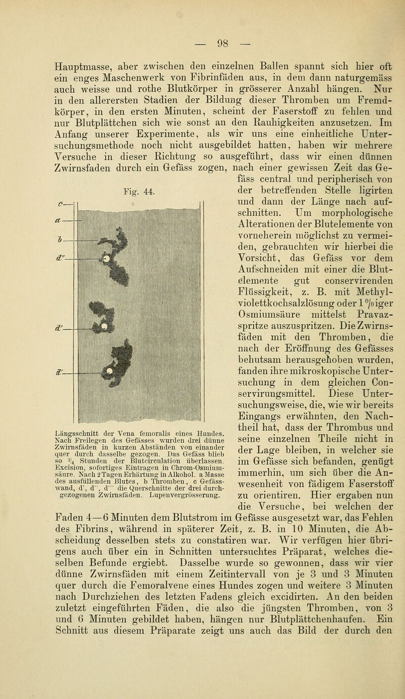 Hauptmasse, aber zwischen den einzelnen Ballen spannt sich hier oft ein enges Maschenwerk von Fibrinfäden aus, in dem dann naturgemäss auch weisse und rothe Blutkörper in grösserer Anzahl hängen. Nur in den allerersten Stadien der Bildung dieser Thromben um Fremd- körper, in den ersten Minuten, scheint der Faserstoff zu fehlen und nur Blutplättchen sich wie sonst an den Rauhigkeiten anzusetzen. Im Anfang unserer Experimente, als wir uns eine einheitliche Unter- suchungsmethode noch nicht ausgebildet hatten, haben wir mehrere Versuche in dieser Richtung so ausgeführt, dass wir einen dünnen Zwirnsfaden durch ein Gefäss zogen, nach einer gewissen Zeit das Ge- fäss central und peripherisch von Fig. 44. der betreffenden Stelle ligirten und dann der Länge nach auf- schnitten. Um morphologische Alterationen der Blutelemente von vorneherein möglichst zu vermei- den, gebrauchten wir hierbei die Vorsicht, das Gefäss vor dem Aufschneiden mit einer die Blut- elemente gut conservirenden Flüssigkeit, z. B. mit Methyl- violettkochsalzlösung oder 1 '^joiger Osmiumsäure mittelst Pravaz- spritze auszuspritzen. Die Zwirns- fäden mit den Thromben, die nach der Eröffnung des Gefässes behutsam herausgehoben wurden, fanden ihre mikroskopische Unter- suchung in dem gleichen Con- servirungsmittel. Diese Unter- suchungsweise, die, wie wir bereits Eingangs erwähnten, den Nach- theil hat, dass der Thrombus und seine einzelnen Theile nicht in der Lage bleiben, in welcher sie im Gefässe sich befanden, genügt immerhin, um sich über die An- wesenheit von fädigem Faserstoff zu Orientiren. Hier ergaben nun die Versuche, bei welchen der Faden 4—6 Minuten dem Blutstrom im Gefässe ausgesetzt war, das Fehlen des Fibrins, während in späterer Zeit, z. B. in 10 Minuten, die Ab- scheidung desselben stets zu constatiren war. Wir verfügen hier übri- gens auch über ein in Schnitten untersuchtes Präparat, welches die- selben Befunde ergiebt. Dasselbe wurde so gewonnen, dass wir vier dünne Zwirnsfäden mit einem Zeitintervall von je 3 und 3 Minuten quer durch die Femoralvene eines Hundes zogen und weitere 3 Minuten nach Durchziehen des letzten Fadens gleich excidirten. An den beiden zuletzt eingeführten Fäden, die also die jüngsten Thromben, von 3 und 6 Minuten gebildet haben, hängen nur Blutplättchenhaufen. Ein Schnitt aus diesem Präparate zeigt uns auch das Bild der durch den Längssclmitt der Vena femoralis eines Hundes. Nach Freilegen des Gefässes wurden drei dünne Zwirnsfäden in kurzen Abständen von einander quer durch dasselbe gezogen. Das G-efäss blieb so 3/^ Stunden der Blutcirculation überlassen. Excision, sofortiges Eintragen in Chrom-Osmium- säure. Nach 2 Tagen Erhärtung in Alkohol, a Masse des ausfüllenden Elutes, b Thromben, c Gefäss- wand, d', d, d' die Querschnitte der drei durch- gezogenen Zwirnsfäden. Lupenvergrösserung.