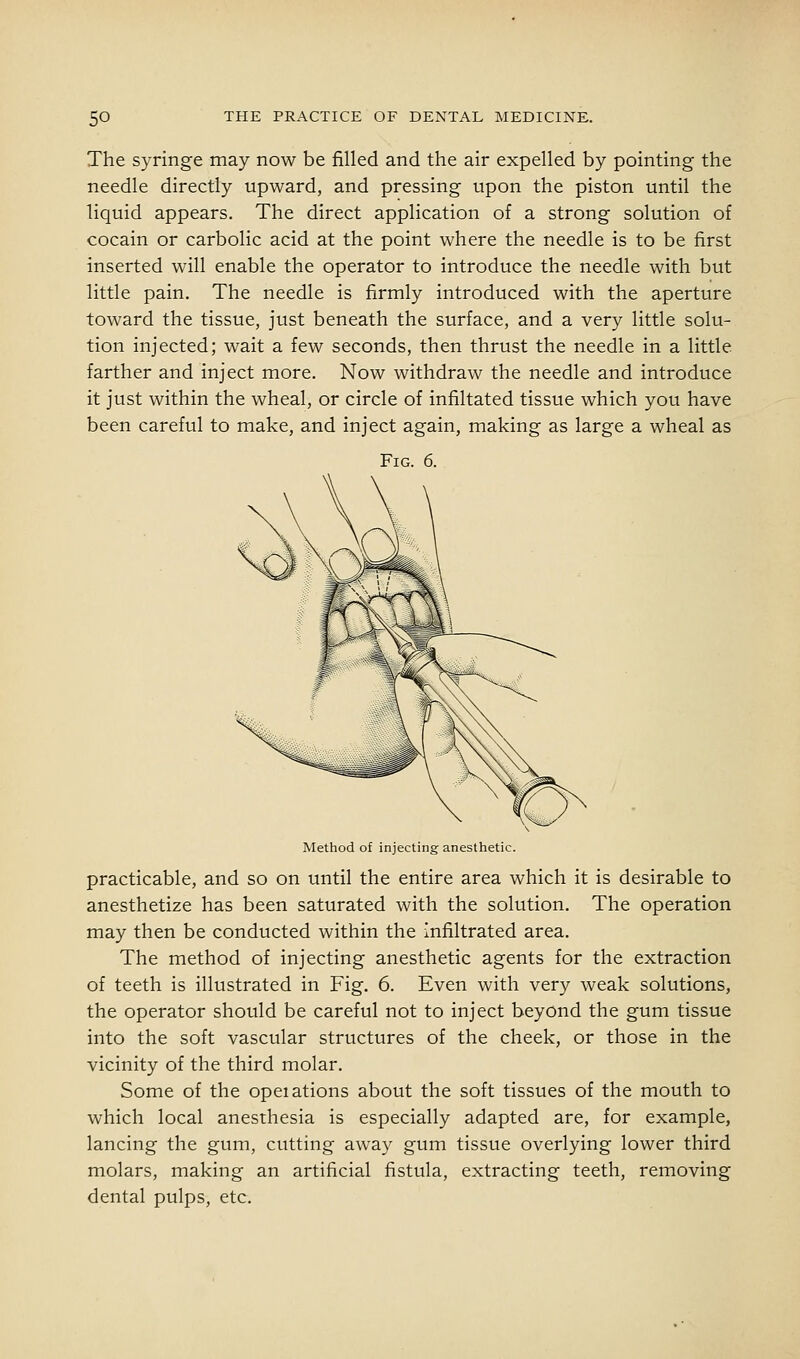 The syringe may now be filled and the air expelled by pointing the needle directly upward, and pressing upon the piston until the liquid appears. The direct application of a strong solution of cocain or carbolic acid at the point where the needle is to be first inserted will enable the operator to introduce the needle with but little pain. The needle is firmly introduced with the aperture toward the tissue, just beneath the surface, and a very little solu- tion injected; wait a few seconds, then thrust the needle in a little farther and inject more. Now withdraw the needle and introduce it just within the wheal, or circle of infiltated tissue which you have been careful to make, and inject again, making as large a wheal as Fig. 6. Method of injecting anesthetic. practicable, and so on until the entire area which it is desirable to anesthetize has been saturated with the solution. The operation may then be conducted within the infiltrated area. The method of injecting anesthetic agents for the extraction of teeth is illustrated in Fig. 6. Even with very weak solutions, the operator should be careful not to inject beyond the gum tissue into the soft vascular structures of the cheek, or those in the vicinity of the third molar. Some of the opeiations about the soft tissues of the mouth to which local anesthesia is especially adapted are, for example, lancing the gum, cutting away gum tissue overlying lower third molars, making an artificial fistula, extracting teeth, removing dental pulps, etc.