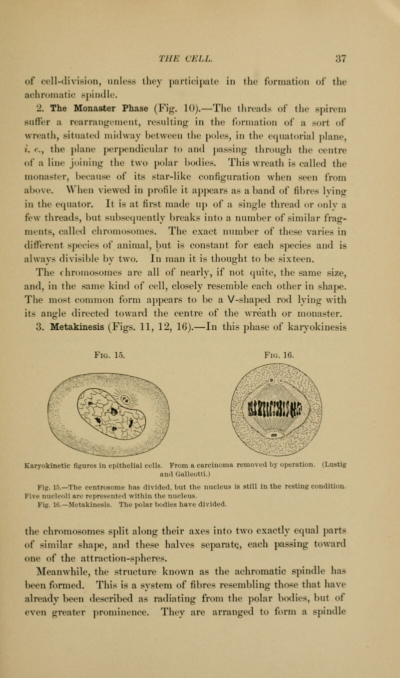 of cell-division, unless they participate in the formation of the achromatic s})indle. 2, The Monaster Phase (Fig. 10).—The threads of the spirem suffer a rearrangement, resulting in the formation of a sort of wreath, situated midway between the poles, in the equatorial plane, i. e., the plane perpendicular to and j)assing through the centre of a line joining the two polar bodies. This wreath is called the monaster, because of its star-like configuration when seen from above. When viewed in })rofile it appears as a band of fibres Iving in the equator. It is at first made up of a single thread or only a few threads, but subse(juently breaks into a number of similar frag- ments, called chromosomes. The exact number of these varies in different species of animal, but is constant for each species and is always divisible by two. In man it is thought to be sixteen. The chromosomes are all of nearly, if not quite, the same size, and, in the same kind of cell, closely resemble each other in shape. The most common form appears to be a V-shaped rod lying with its angle directed toward the centre of the wreath or monaster. 3. Metakinesis (Figs. 11, 12, 16).—In this phase of karyokiuesis Fig. 15. Fig. 16. Karyokinetic figures in epithelial cells. From a carcinoma removed by operation. (Lustig and Galleotti.) Fig. 15.—The centrosome has divided, but the nucleus is still in the resting condition. Five nucleoli are represented within the nucleus. Fig. 16.—Metakinesis, The polar bodies have divided. the chromosomes split along their axes into two exactly equal parts of similar shajie, and these halves separate, each passing toward one of the attraction-spheres. Meanwhile, the structure known as the achromatic spindle has been formed. This is a system of fibres resembling tho.se that have already been described as radiating from the polar bodies, but of even greater prominence. They are arranged to form a spindle