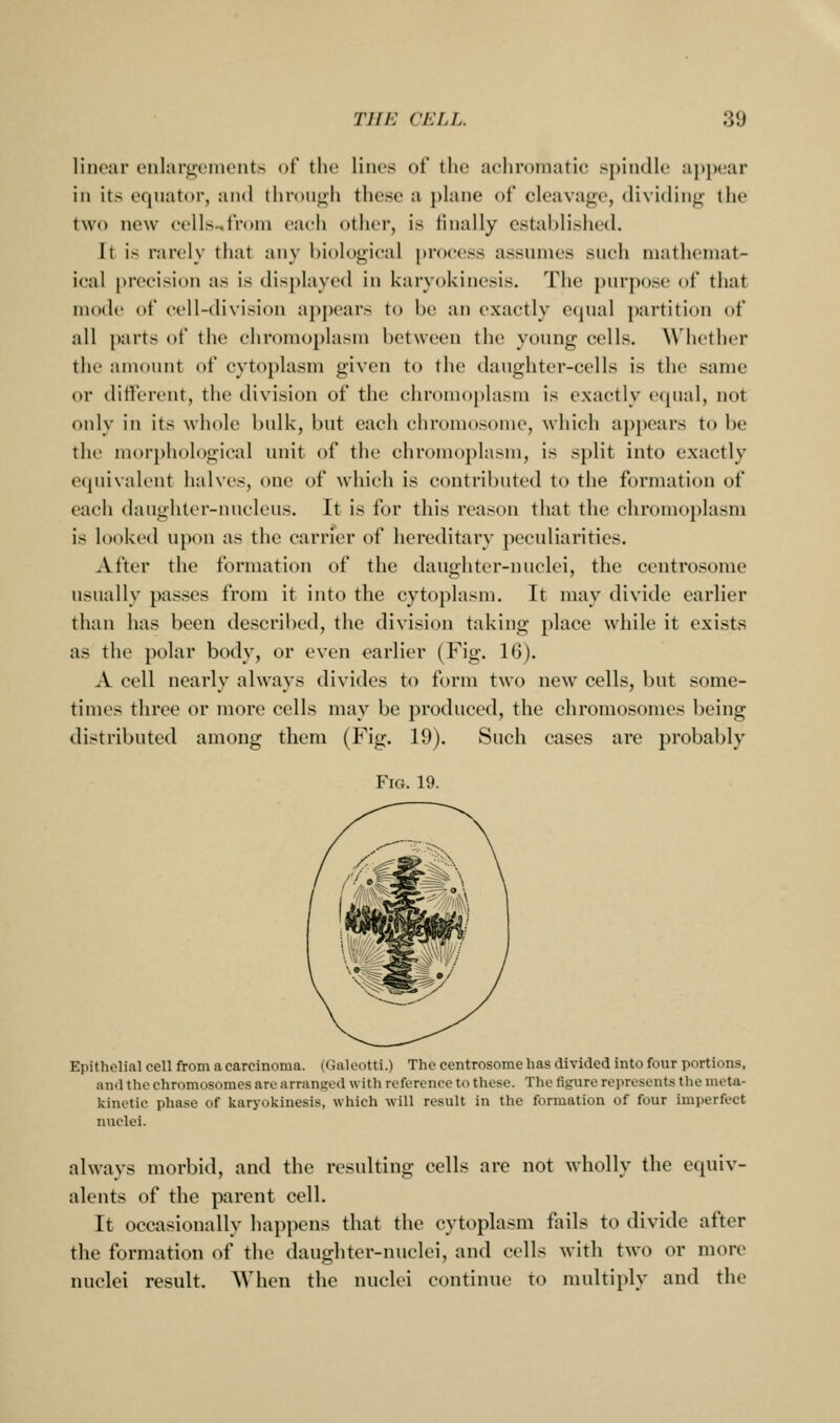 linear cnlai'i:;('mcnts of the lines of the achromatic spindle appear in its equator, and thn»M<;h these a plane of cleavage, dividing the two new eells^froni each otlier, is finally established. It is rarely that any l)iol()gieal process assumes such mathemat- ical [)rccision as is displayed in karyokinesis. The purpose of that mode of cell-division a})pears to be an exactly equal partition of all parts of the chromoplasm between the young cells. Whether the amount of cytoplasm given to the daughter-cells is the same or different, the division of the chromoj)lasm is exactly equal, not only in its whole bulk, but each chromosome, which appears to be the morphological unit of the chromoplasm, is split into exactly eipiivalent halves, one of which is contrll)uted to the formation of each daughter-nucleus. It is for this reason that the chromoplasm is looked upon as the carrier of hereditary peculiarities. After the formation of the daugiiter-nuclei, the centrosome usually passes from it into the cytoplasm. It may divide earlier than has been described, the division taking place while it exists as the polar body, or even earlier (Fig. 16). A cell nearly always divides to form two new cells, but some- times three or more cells may be produced, the chromosomes being distributed among them (Fig. 19). Such cases are probably Fig. 19. Epithelial cell from a carcinoma. (Galeotti.) The centrosome has divided into four portions, and the chromosomes are arranged with reference to these. The figure represents the meta- kinetic phase of karyokinesis, which will result in the formation of four imperfect nuclei. always morbid, and the resulting cells are not wholly the equiv- alents of the parent cell. It occasionally happens that the cytoplasm fiiils to divide after the formation of the daughter-nuclei, and cells with two or more nuclei result. When the nuclei continue to multiply and the