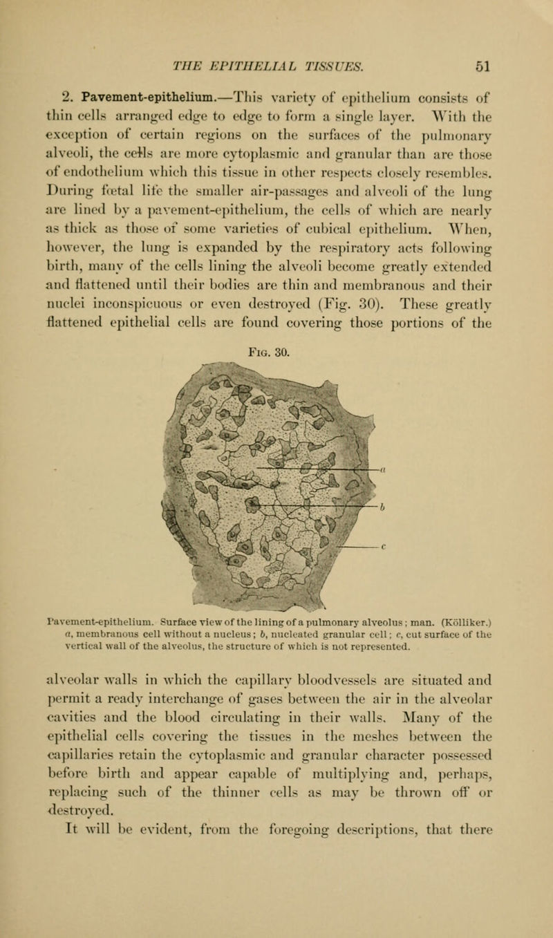 2. Pavement-epithelium.—This variety of epithelium consists of thin cells arranged edge to edge to form a single layer. With the exception of certain regions on the surfaces of the pulmonary alveoli, the ceHs are more cytoj)lasmic and granular than are those of endothelium which this tissue in other respects closely resembles. During fietal life the smaller air-])assages and alveoli of the lung are lined by a pavement-epithelium, the cells of which are nearly as thick as those of some varieties of cubical epithelium. When, lu»\v('ver, the lung is expanded by the respiratory acts following birth, many of the cells lining the alveoli become greatly extended and flattened until their boflies are thin and membranous and their nuclei inconsj)icuous or even destroyed (Fig. 30). These greatly flattened epithelial cells are found covering those portions of the Fig. 30. ravement-epithelium. Surface view ot the lining of a pulmonary alveolus ; man. (KoUiker.) (I, membranous cell without a nucleus; 6, nucleated granular cell; r, cut surface of the vertical wall of the alveolus, the structure of which is not represented. alveolar walls in which the capillary bloodvessels are situated and permit a ready interchange of gases between the air in the alveolar cavities and the blood circulating in their walls. Many of the epithelial cells covering the tissues in the meshes between the capillaries retain the cytoplasmic and granular character posses.sed before birth and appear capable of multiplying and, perhaps, replacing such of the thinner cells as may be thrown otf t)r destroyed. It will be evident, from the foregoing descriptions, that there