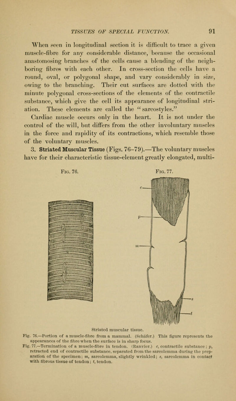 ^^'lK'Il .<ec'ii in lon^itiulimil section it is diilicult to trace a given muscle-fibre for any considerable distance, because the occasional anastomosing branches of the cells cause a blending of the neigh- boring Hbrt« with ea(;h other. In cross-section the cells have a round, oval, or polygonal shape, and vary considerably in size, owing to the branching. Their cut surfaces are dotted with the minute polygonal cross-sections of the elements of the contractile substance, which give the cell its appearance of longitudinal stri- ation. These elements are called the  sarcostyles. Cardiac nuis(^le occurs only in the heart. It is not luider the control of the will, but differs from the other involuntary nuiscles in the force and rapidity of its contractions, which resemble those of the voluntary muscles. 3. Striated Muscular Tissue (Figs. 76-79).—The voluntary muscles have for their characteristic tissue-element greatly elongated, multi- FiG. 76. Fig. 77. i;r,......j^...............;;;;;;.|j^ jjij;;; , ;;;•■•■■ lg;{;;{;|;;ii-''it;;;i;t;:;;::;::::: striated muscular tissue. Fig. 76.—Portion of a muscle-fibre from a mammal. (Schiifer.) This figure represents the appearances of the fibre when the surface i.s in sharj> focus. Fig. 77.—Termination of a muscle-fibre in tendon. (Kanvier.) c, contractile substance; p, retracted end of contractile substance, separated from the sarcolemma during the prep- aration of the specimen; m, sarcolemma, slightly wrinkled; s, sarcolemma in contact with fibrous tissue of tendon; t, tendon.