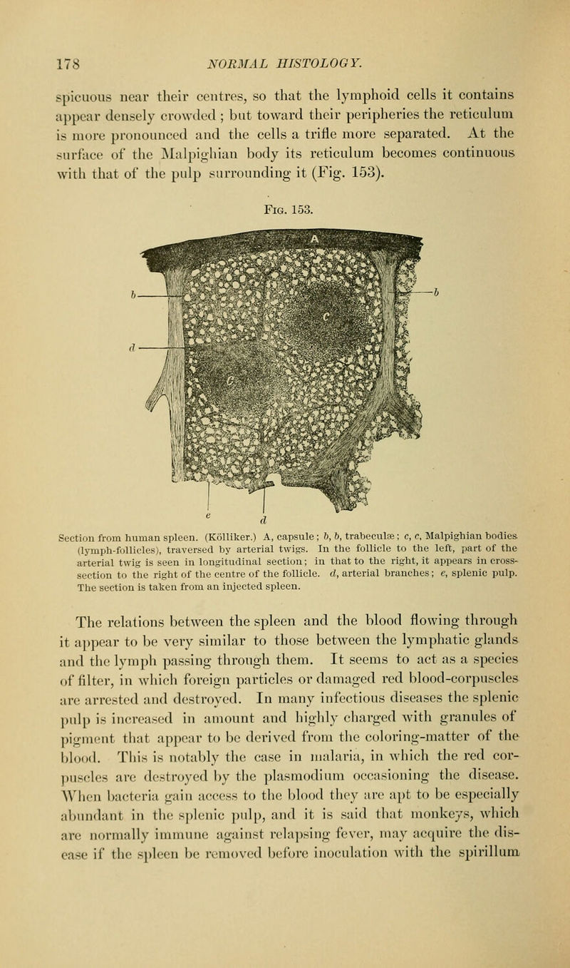 spicuous near their centres, so that the lymphoid cells it contains ai)pear densely crowded ; but toward their peripheries the reticulum is more pronounced and tlie cells a trifle more separated. At the surface of the Malpighian body its reticulum becomes continuous with that of the pulp surrounding it (Fig. 153). Fig. 153. Section from human spleen. (KoUiker.) A, capsule; 6, b, trabeculee; c, e, Malpighian bodies (lymph-follicles), traversed by arterial twigs. In the follicle to the left, part of the arterial twig is seen in longitudinal section; in that to the right, it appears in cross- section to the right of the centre of the follicle, d, arterial branches; e, splenic pulp. The section is taken from an injected spleen. The relations between the spleen and the blood flowing through it appear to be very similar to those between the lymphatic glands and the lymph passing through them. It seems to act as a species of filter, in which foreign particles or damaged red blood-corpu.scle& are arrested and destroyed. In many infectious diseases the splenic pulp is increased in amount and highly charged with granules of pigment that appear to be derived from the coloring-matter of the blood. This is notably the case in malaria, in which the red cor- puscles are destroyed by the plasraodium occasioning the disease. AVhen bacteria gain access to the blood they are apt to be especially abundant in the splenic pulp, and it is said that monkeys, which are normally immune against relapsing fever, may acquire the dis- ease if the spleen be removed before inoculation with the spirillum