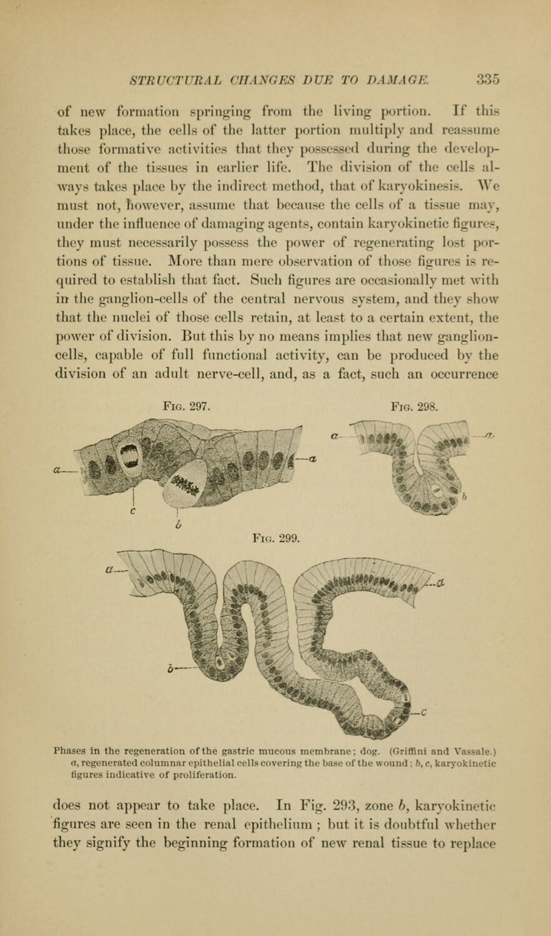 of new formation spriiifjjing from the living portion. If this takes place, the cells of the latter portion multiply and reassume those formative activities that they possessed during the develop- ment of the tissues in earlier life. The division of the cells al- ways tidvcs place by the indirect method, that of karyokinesis. We must not, however, assume that because the cells of a tissue may, under the influence of damaging agents, contain karyokinetic figures, they must necessarily possess the power of regenerating lost por- tions of tissue. More than mere observation of those figures is re- quired to establish that fact. Such figures are occasionally met with in the ganglion-cells of the central nervous system, and they show that the nuclei of those cells retain, at least to a certain extent, the power of division. But this by no means implies that new ganglion- cells, capable of full functional activity, can be produced by the division of an adult nerve-cell, and, as a fact, such an occurrence Fi<;. 297 Fig. 298. f,|--a ^t$m m-b^^ .:ymmh. gf^,^/.tf Phases in the regeneration of the gastric mucous membrane; dog. (Griffini and Vassale.) a, regenerated columnar epithelial cells covering the base of the wound; 6, c, karyokinetic figures indicative of proliferation. does not appear to take place. In Fig, 293, zone h, karyokinetic figures are seen in the renal epithelium ; but it is doubtful Avhcther they signify the beginning formation of new renal tissue to replace