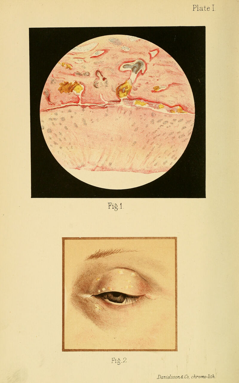 Plate I Rg.l. Fig.2. Danielsson&Co, chromo-liih.