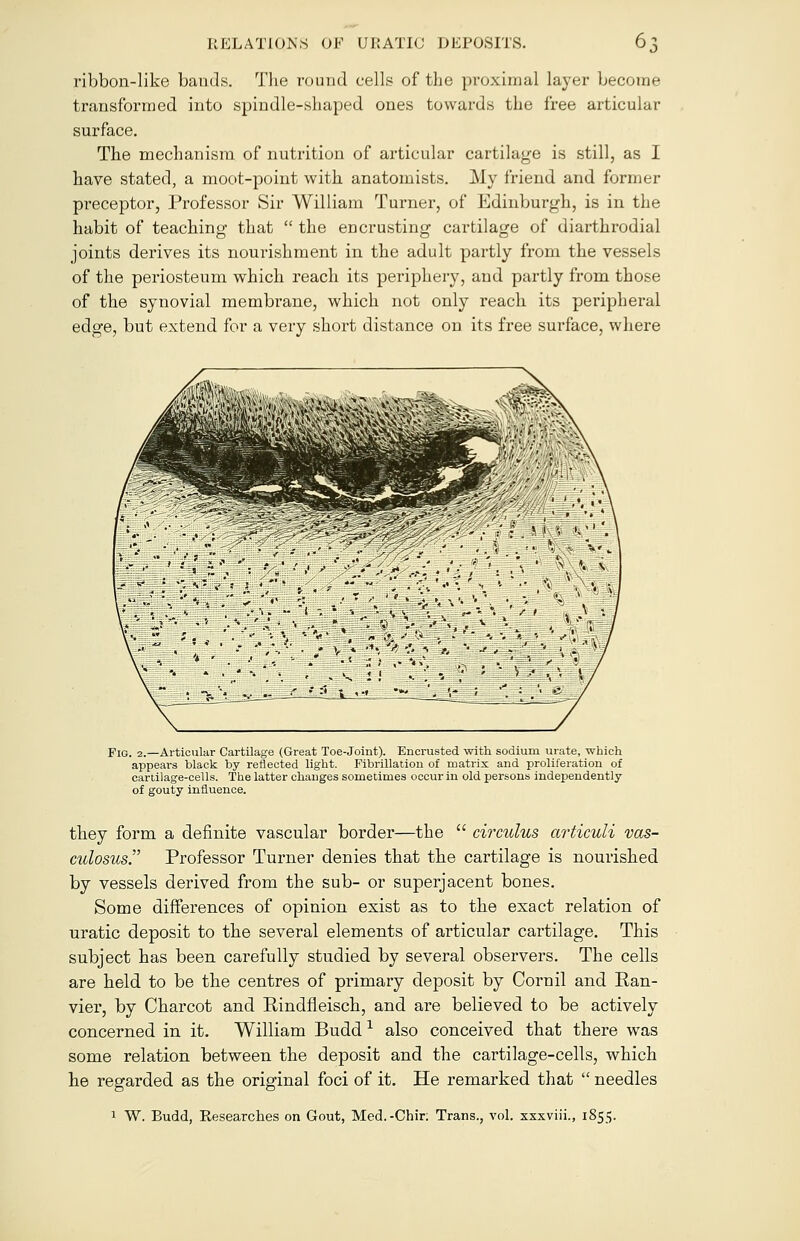 ribbon-like bands. The round cells of the proximal layer become transformed into spindle-shaped ones towards the free articular surface. The mechanism of nutrition of articular cartilage is still, as I have stated, a moot-point with anatomists. Aly friend and former preceptor, Professor Sir William Turner, of Edinburgh, is in the habit of teaching that  the encrusting cartilage of diarthrodial joints derives its nourishment in the adult partly from the vessels of the periosteum which reach its periphery, and partly from those of the synovial membrane, which not only reach its peripheral edge, but extend for a very short distance on its free surface, where Fig. 2.—Articular Cartilage (Great Toe-Joint). Encrusted with, sodium urate, which appears black by reflected light. Fibrillation of matrix and proliferation of cartilage-cells. The latter changes sometimes occur in old persons independently of gouty influence. they form a definite vascular border—the  circuius articuli vas- culosus. Professor Turner denies that the cartilage is nourished by vessels derived from the sub- or superjacent bones. Some differences of opinion exist as to the exact relation of uratic deposit to the several elements of articular cartilage. This subject has been carefully studied by several observers. The cells are held to be the centres of primary deposit by Cornil and Ean- vier, by Charcot and Rindfieisch, and are believed to be actively concerned in it. William Budd1 also conceived that there was some relation between the deposit and the cartilage-cells, which he regarded as the original foci of it. He remarked that  needles 1 W. Budd, Researches on Gout, Med.-Chir: Trans., vol. xxxviii., 1855.