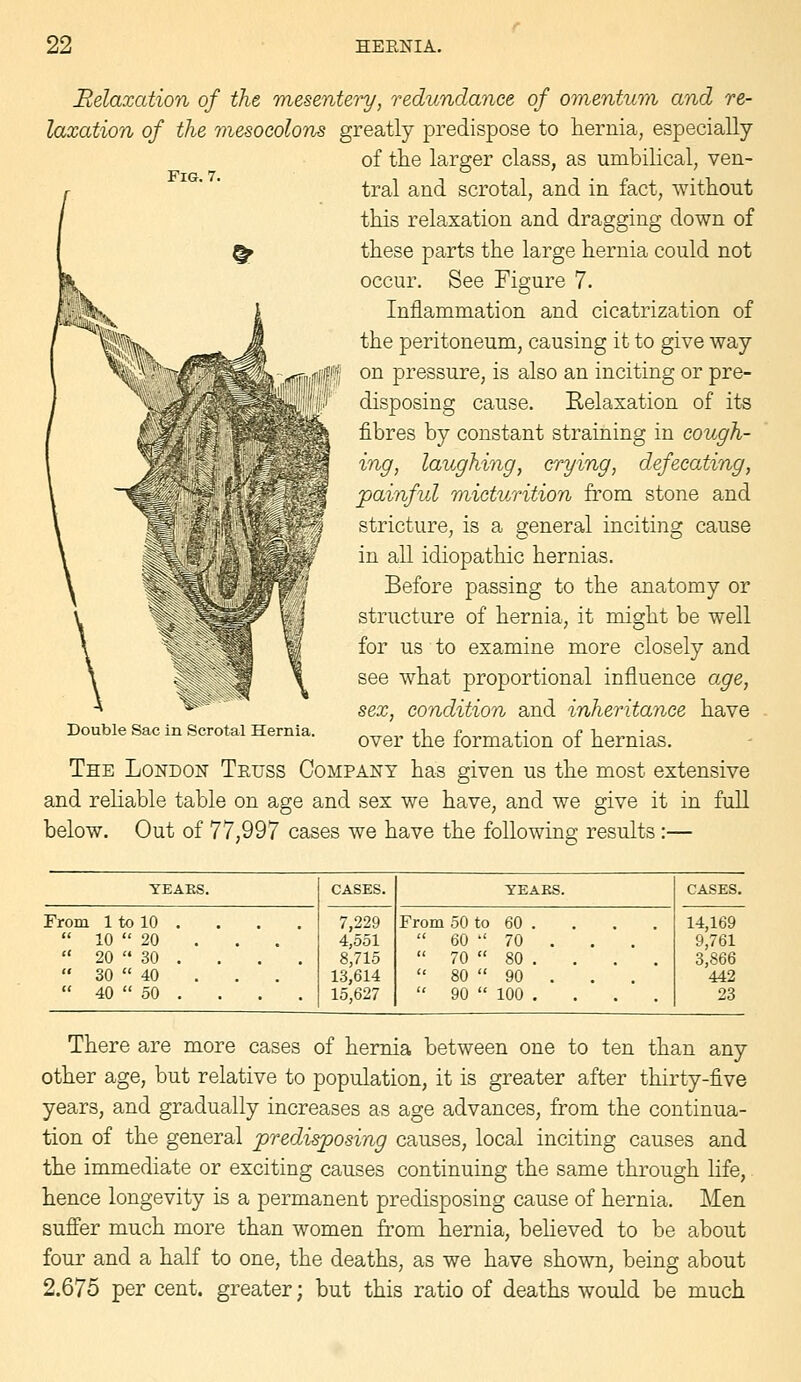 Fig. 7. Relaxation of the, mesentery, redundance of omentum and re- laxation of the mesocolons greatly predispose to hernia, especially of the larger class, as umbilical, ven- tral and scrotal, and in fact, without this relaxation and dragging down of these parts the large hernia could not occur. See Figure 7. Inflammation and cicatrization of the peritoneum, causing it to give way on pressure, is also an inciting or pre- disposing cause. Relaxation of its fibres by constant straining in cough- ing, laughing, crying, defecating, paiyifid micturition from stone and stricture, is a general inciting cause in all idiopathic hernias. Before passing to the anatomy or structure of hernia, it might be well for us to examine more closely and see what proportional influence age, sex, condition and inheritance have over the formation of hernias. The London Teuss Company has given us the most extensive and reliable table on age and sex we have, and we give it in full below. Out of 77,997 cases we have the following results:— Double Sac in Scrotal Hernia. YEAES. CASES. YEARS. CASES. From 1 to 10 . 7,229 From 50 to 60 . 14,169  10  20 4,551  60  70 . 9,761  20  30 . 8,715  70  80 . 3,866  30  40 13,614  80  90 . 442  40  50 . 15,627  90  100 . 23 There are more cases of hernia between one to ten than any other age, but relative to population, it is greater after thirty-five years, and gradually increases as age advances, from the continua- tion of the general predisposing causes, local inciting causes and the immediate or exciting causes continuing the same through life, hence longevity is a permanent predisposing cause of hernia. Men suffer much more than women from hernia, believed to be about four and a half to one, the deaths, as we have shown, being about 2.675 per cent, greater; but this ratio of deaths would be much