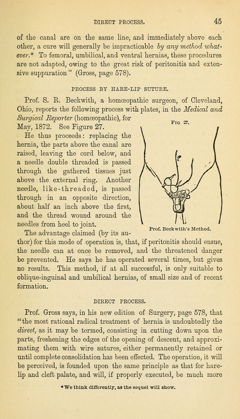 Fig 27. of the canal are ori the same line, and imtnediately ahove each other, a cure will generally be impracticable hy any method what' ever.* To femoral, umbilical, and ventral hernias, these procedures are not adapted, owing to the great risk of peritonitis and exten- sive suppuration  (Gross, page 578). PEOCESS BY HARE-LIP SUTURE. Prof. S. E. Beckwith, a homoeopathic surgeon, of Cleveland, Ohio, reports the following process with plates, in the Medical and Surgical Reporter (homoeopathic), for May, 1872. See Figure 27. He thus proceeds: replacing the hernia, the parts above the canal are raised, leaving the cord below, and a needle double threaded is passed through the gathered tissues just above the external ring. Another needle, like-threaded, is passed through in an opposite direction, about half an inch above the first, and the thread wound around the needles from heel to joint. The advantage claimed (by its au- thor) for this mode of operation is, that, if peritonitis should ensue, the needle can at once be removed, and the threatened danger be prevented. He says he has operated several times, but gives no results. This method, if at all successful, is only suitable to oblique-inguinal and umbilical hernias, of small size and of recent formation. Prof. Beckwitti's Method. DIRECT PEOCESS. Prof. Gross says, in his new edition of Surgery, page 578, that the most rational radical treatment of hernia is undoubtedly the direct, as it may be termed, consisting in cutting down upon the parts, freshening the edges of the opening of descent, and approxi- mating them with wire sutures, either permanently retained or ■until complete consolidation has been effected. The operation, it will be perceived, is founded upon the same principle as that for hare- lip and cleft palate, and will, if properly executed, be much more ♦We think differently, as the sequel will show.