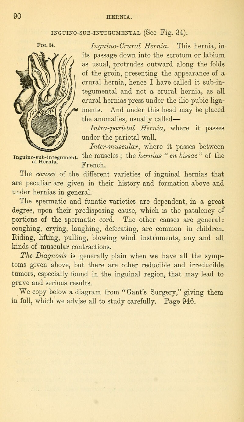 INGUINO-SUB-INTEGUMENTAL (See Fig. 34). Fig-34. Inguino-Crural Hernia. This hernia, in- its passage down into the scrotum or labium as usual, protrudes outward along the folds of the groin, presenting the appearance of a crural hernia, hence I have called it sub-in- tegumental and not a crural hernia, as all crural hernias press under the ilio-pubic liga- ments. And under this head may be placed the anomalies, usually called— Intra-parietal Hernia, where it passes under the parietal wall. Inter-muscular, where it passes between inguino-sub-integumeBt- ^^^ muscles; the hemias  en bissac  of the al Hernia. ^^^^^^^ The causes of the different varieties of inguinal hernias that are peculiar are given in their history and formation above and under hernias in general. The spermatic and fanatic varieties are dependent, in a great degree, upon their predisposing cause, which is the patulency of portions of the spermatic cord. The other causes are general: coughing, crying, laughing, defecating, are common in children. Eiding, lifting, pulling, blowing wind instruments, any and all kinds of muscular contractions. The Diagnosis is generally plain when we have all the symp- toms given above, but there are other reducible and irreducible tumors, especially found in the inguinal region, that may lead to grave and serious results. We copy below a diagram from  Gant's Surgery, giving them in full, which we advise all to study carefully. Page 946.