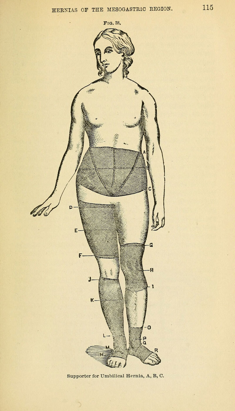 Fig. 38. 115 Supporter for Umbilical Hernia, A, B, C.