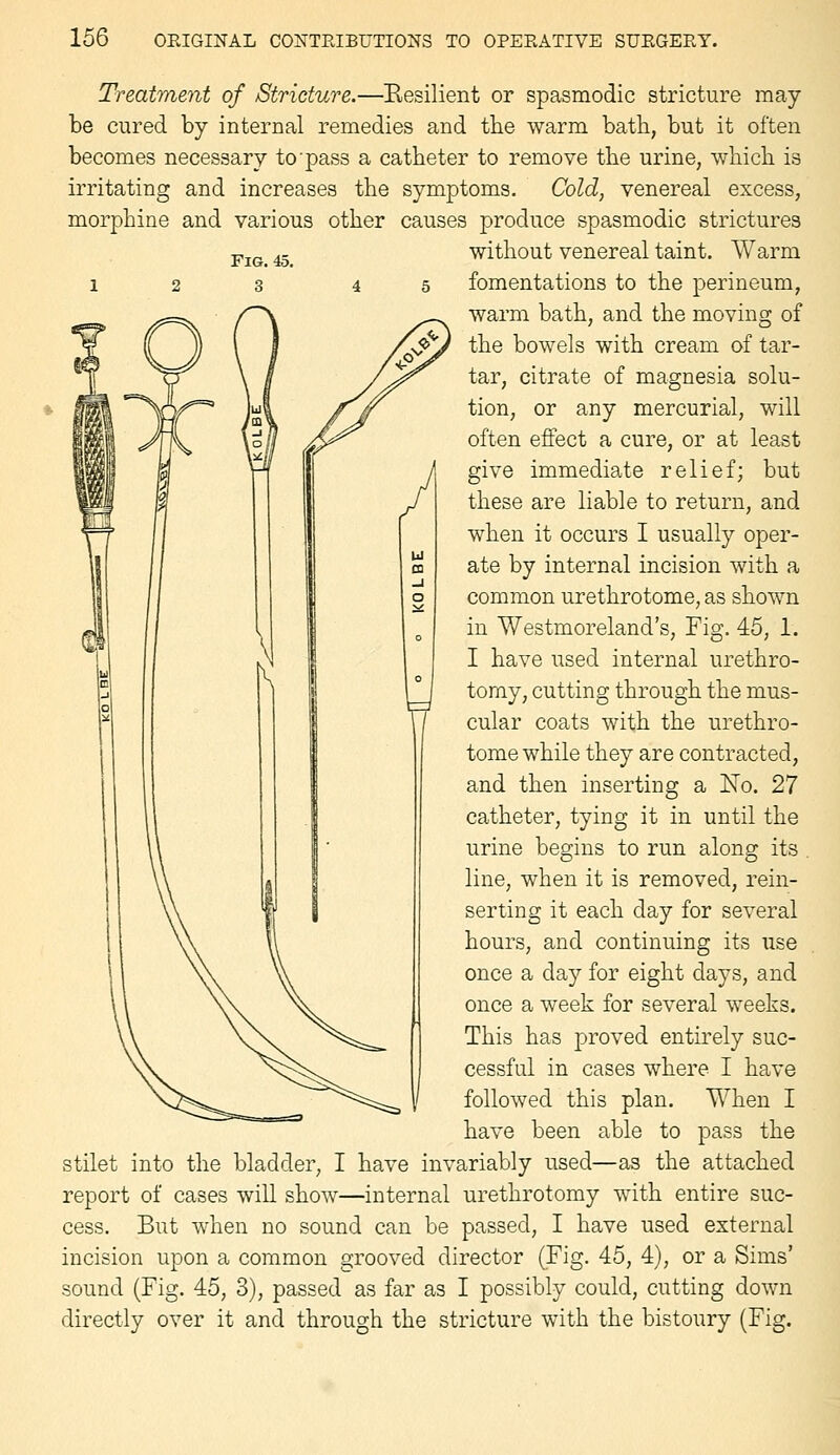 Treatment of Stricture.—Eesilient or spasmodic stricture may be cured by internal remedies and tbe warm bath, but it often becomes necessary to pass a catheter to remove the urine, which is irritating and increases the symptoms. Cold, venereal excess, morphine and various other causes produce spasmodic strictures without venereal taint. Warm fomentations to the perineum, warm bath, and the moving of the bowels with cream of tar- tar, citrate of magnesia solu- tion, or any mercurial, will often effect a cure, or at least give immediate relief; but these are liable to return, and w^hen it occurs I usually oper- ate by internal incision with a common urethrotome, as shown in Westmoreland's, Fig. 45, 1. I have used internal urethro- tomy, cutting through the mus- cular coats with the urethro- tome while they are contracted, and then inserting a No. 27 catheter, tying it in until the urine begins to run along its . line, when it is removed, rein- serting it each day for several hours, and continuing its use once a day for eight days, and once a week for several weeks. This has proved entirely suc- cessful in cases where I have followed this plan. When I have been able to pass the stilet into the bladder, I have invariably used—as the attached report of cases will show—internal urethrotomy with entire suc- cess. But when no sound can be passed, I have used external incision upon a common grooved director (Fig. 45, 4), or a Sims' sound (Fig. 45, 3), passed as far as I possibly could, cutting down directly over it and through the stricture with the bistoury (Fig.