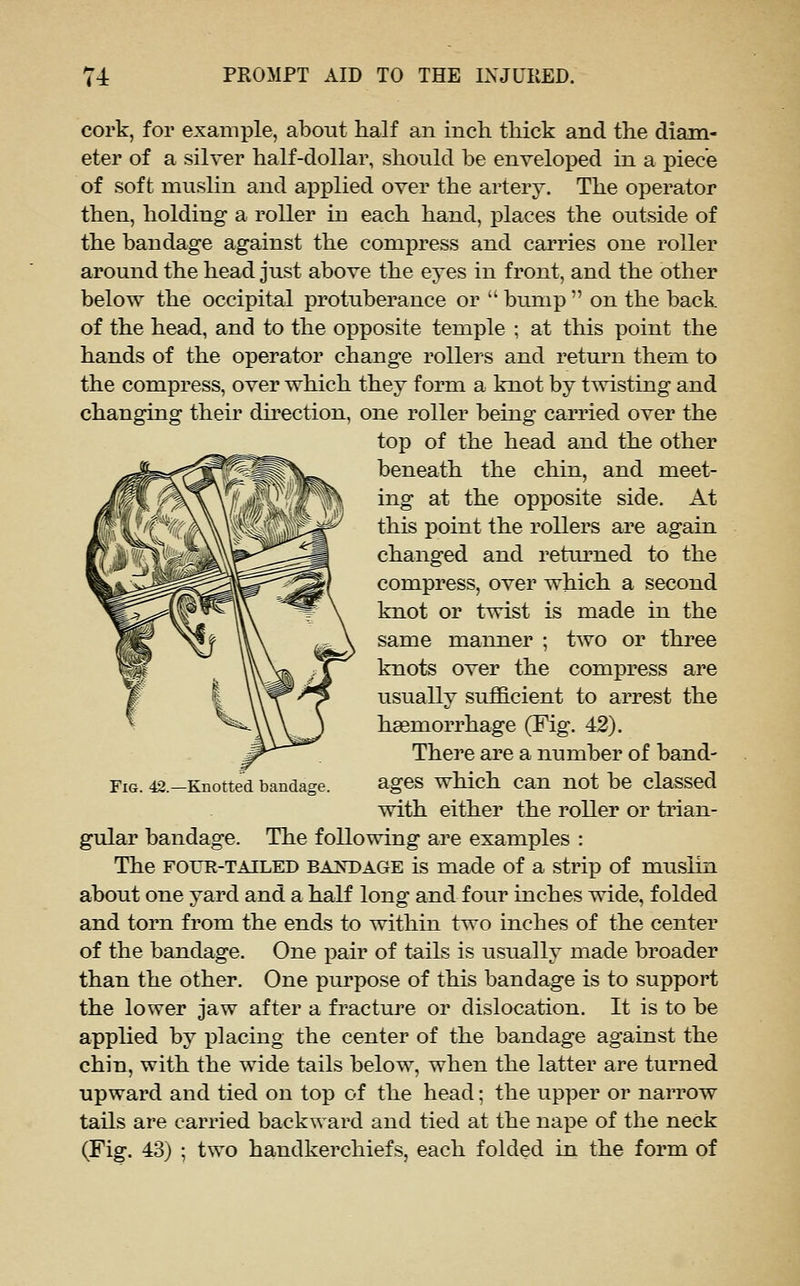 cork, for example, about half an inch thick and the diam- eter of a silver half-dollar, should be enveloped in a piece of soft muslin and axoplied over the artery. The operator then, holding a roller in each hand, places the outside of the bandage against the compress and carries one roller around the head just above the eyes in front, and the other below the occipital protuberance or  bump  on the back of the head, and to the opposite temple ; at this point the hands of the operator change rollers and return them to the compress, over which they form a knot by twisting and changing theii' dh^ection, one roller being carried over the top of the head and the other beneath the chin, and meet- ing at the opposite side. At this point the rollers are again changed and returned to the compress, over which a second knot or twist is made in the same manner ; two or three knots over the compress are usually sufficient to arrest the haemorrhage (Fig. 42). There are a number of band- ages which can not be classed with either the roller or trian- gular bandage. The following are examples : The FOUR-TAILED bajST)age is made of a strip of muslin about one yard and a half long and four inches wide, folded and torn from the ends to within two inches of the center of the bandage. One jDair of tails is usually made broader than the other. One purpose of this bandage is to support the lower jaw after a fracture or dislocation. It is to be applied by placing the center of the bandage against the chin, with the wide tails below, when the latter are turned upward and tied on top of the head; the upper or narrow tails are carried backward and tied at the nape of the neck (Fig. 43) ; two handkerchiefs, each folded in the form of Fig. 42.—Knotted bandage.