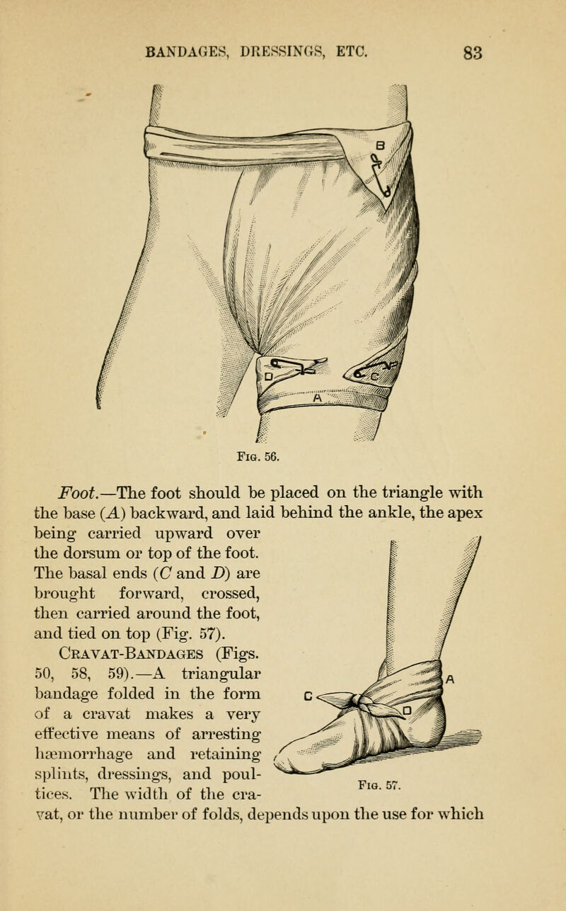 Fig. 56. Foot.—The foot should be placed on the triangle with the base {A) backward, and laid behind the ankle, the apex being carried upward over the dorsum or top of the foot. The basal ends (C and D) are brought forward, crossed, then carried around the foot, and tied on top (Fig. 57). Cravat-Bandages (Figs. 50, 58, 59).—A triangular bandage folded in the form of a cravat makes a very effective means of arresting hemorrhage and retaining splints, dressings, and poul- tices. The width of the cra- vat, or the number of folds, dei^ends upon the use for which