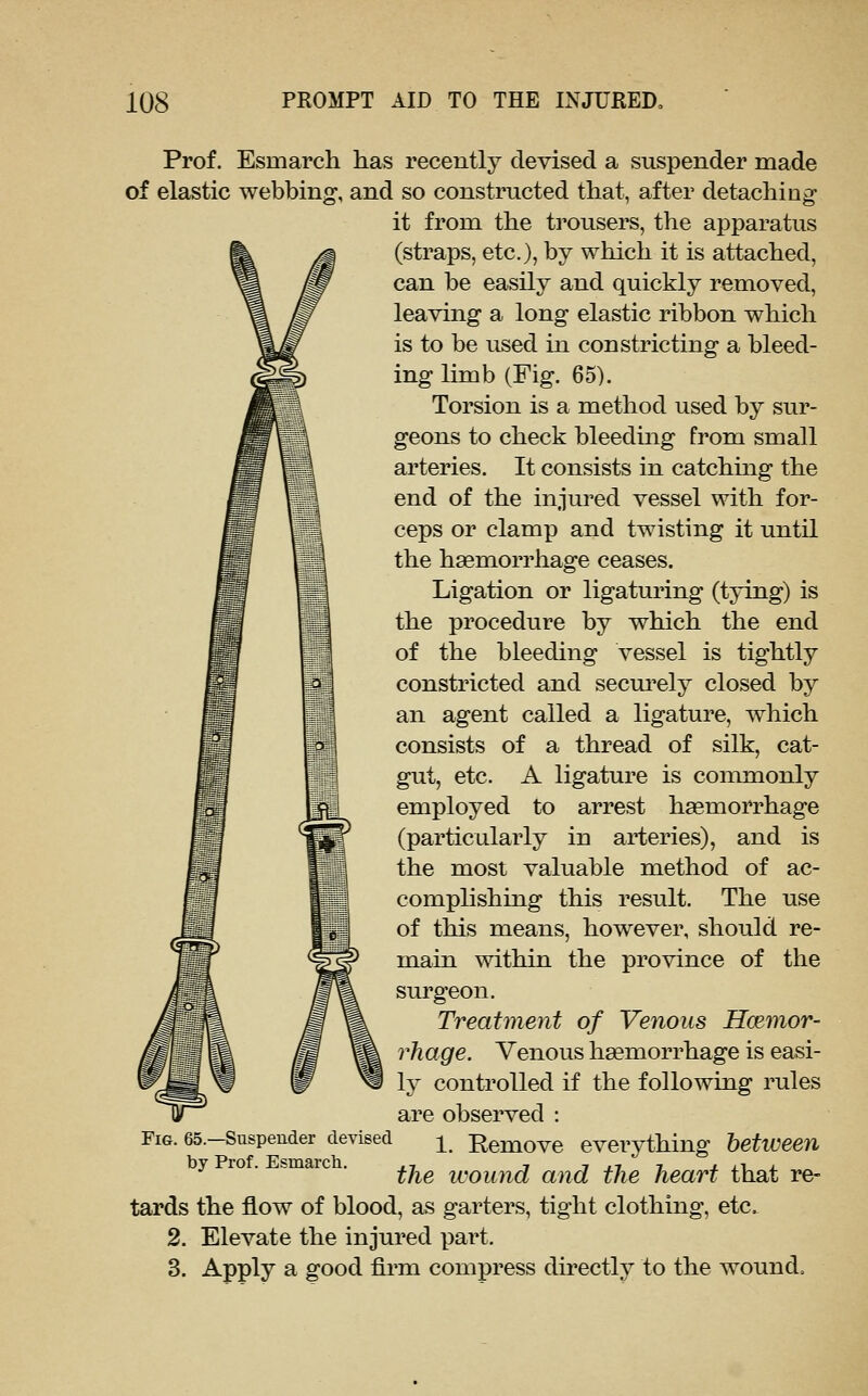 Prof. Esmarch has recently devised a suspender made of elastic webbing, and so constructed that, after detaching it from the trousers, the apparatus (straps, etc.), by which it is attached, can be easily and quickly removed, leaving a long elastic ribbon which is to be used in constricting a bleed- ing limb (Fig. 65). Torsion is a method used by sur- geons to check bleeding from small arteries. It consists in catching the end of the injured vessel with for- ceps or clamp and twisting it until the haemorrhage ceases. Ligation or ligaturing (tjong) is the procedure by which the end of the bleeding vessel is tightly constricted and secui'ely closed by an agent called a ligature, which consists of a thread of silk, cat- gut, etc. A ligature is commonly employed to arrest hasmorrhage (particularly in arteries), and is the most valuable method of ac- complishing this result. The use of this means, however, should re- main within the province of the surgeon. Treatment of Venous Hmmor- rhage. Venous haemorrhage is easi- ly controlled if the following rules are observed : Fig. 65.-Suspeader devised -^ Remove everything between y ro . smarc . ^^^ icoiuid and the heart that re- tards the flow of blood, as garters, tight clothing, etc. 2. Elevate the injured part. 3. Apply a good firm compress directly to the wound.