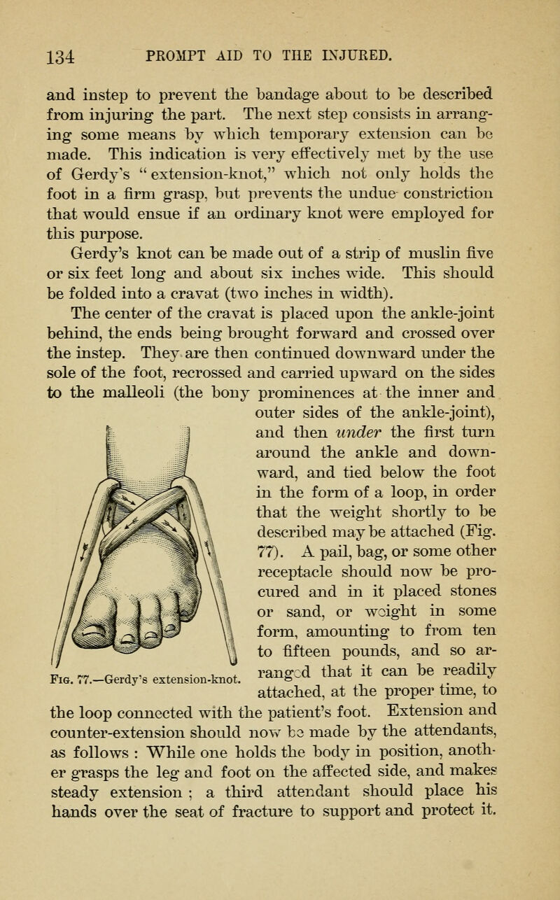 and instep to prevent the bandage about to be described from injuring the part. The next step consists in arrang- ing some means by which temporary extension can be made. This indication is very effectively met by the use of Gerdy's  extension-knot, which not only holds the foot in a firm grasp, but prevents the undue constriction that would ensue if an ordinary knot were employed for this purpose. Gerdy's knot can be made out of a strip of muslin five or six feet long and about six inches wide. This should be folded into a cravat (two inches in width). The center of the cravat is placed upon the ankle-joint behind, the ends being brought forward and crossed over the instep. They are then continued downward under the sole of the foot, recrossed and carried upward on the sides to the malleoli (the bony prominences at the inner and outer sides of the ankle-joint), and then under the first turn around the ankle and down- ward, and tied below the foot in the form of a loop, in order that the weight shortly to be described may be attached (Fig. 77). A pail, bag, or some other receptacle should now be pro- cured and in it placed stones or sand, or weight in some form, amounting to from ten to fifteen pounds, and so ar- ranged that it can be readily attached, at the proper time, to the loop connected with the patient's foot. Extension and counter-extension should now be made by the attendants, as follows : While one holds the body in position, anoth- er grasps the leg and foot on the affected side, and makes steady extension ; a third attendant should place his hands over the seat of fracture to support and protect it. Fig. 77.—Gerdy's extension-knot.