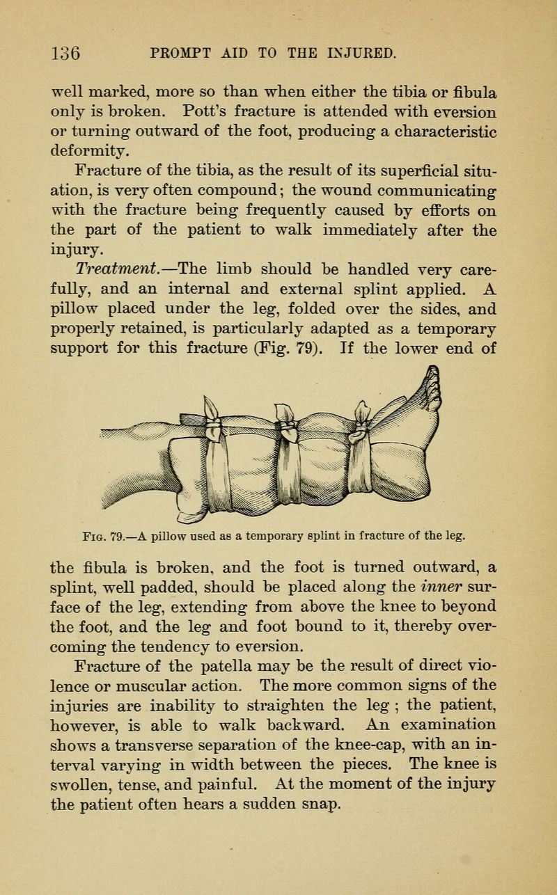 well marked, more so than when either the tibia or fibula only is broken. Pott's fracture is attended with eversion or turning outward of the foot, producing a characteristic deformity. Fracture of the tibia, as the result of its superficial situ- ation, is very often compound; the wound communicating with the fracture being frequently caused by efforts on the part of the patient to walk immediately after the injury. Treatment.—The limb should be handled very care- fully, and an internal and external splint applied. A pillow placed under the leg, folded over the sides, and properly retained, is particularly adapted as a temporary support for this fracture (Fig. 79). If the lower end of Fig. 79.—a pillow used as a temporary splint in fracture of the leg. the fibula is broken, and the foot is turned outward, a splint, well padded, should be placed along the inner sur- face of the leg, extending from above the knee to beyond the foot, and the leg and foot bound to it, thereby over- coming the tendency to eversion. Fracture of the patella may be the result of direct vio- lence or muscular action. The more common signs of the injuries are inability to straighten the leg ; the patient, however, is able to walk backward. An examination shows a transverse separation of the knee-cap, with an in- terval varying in width between the pieces. The knee is swollen, tense, and painful. At the moment of the injury the patient often hears a sudden snap.