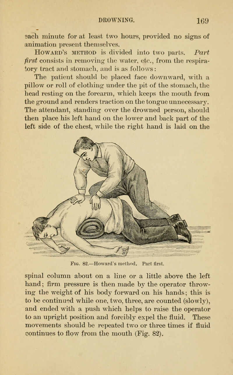 each minute for at least two hours, provided no signs of animation present themselves. Howard's method is divided into two parts. Part first consists in removing the water, etc., from the respira- tory tract and stomach, and is as follows: The patient should be i)laced face downward, with a pillow or roll of clothing under the pit of the stomach, the head resting on the forearm, which keeps the mouth from the ground and renders traction on the tongue unnecessary. The attendant, standing over the drowned person, should then place his left hand on the lower and back part of the left side of the chest, while the right hand is laid on the Fig. 82.—Ho\vards method. Part first. spinal column about on a line or a little above the left hand; firm pressure is then made by the operator throw- ing the weight of his body forward on his hands; this is to be continued while one, two, three, are counted (slowly), and ended with a push w^hich helps to raise the operator to an upright position and forcibly expel the fluid. These movements should be repeated tw^o or three times if fluid continues to flow from the mouth (Fig. 82).