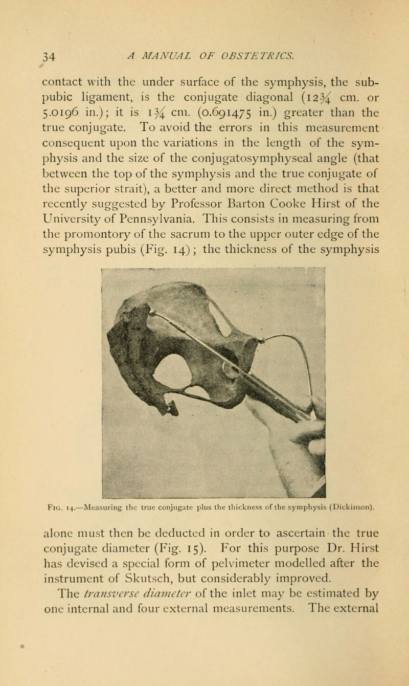 contact with the under surface of the symphysis, the sub- pubic Hgament, is the conjugate diagonal (i2%! cm. or 5.0196 in.); it is i^ cm. (0.691475 in.) greater than the true conjugate. To avoid the errors in this measurement consequent upon the variations in the length of the sym- physis and the size of the conjugatosymphyseal angle (that between the top of the symphysis and the true conjugate of the superior strait), a better and more direct method is that recently suggested by Professor Barton Cooke Hirst of the University of Pennsylvania. This consists in measuring from the promontory of the sacrum to the upper outer edge of the symphysis pubis (Fig. 14); the thickness of the symphysis Fig. 14.—Measuring tlic true conjugate plus tl kucss of tlic sympliysis (Dickinson). alone must then be deducted in order to ascertain the true conjugate diameter (Fig. 15). For this purpose Dr. Hirst has devised a special form of pelvimeter modelled after the instrument of Skutsch, but considerably improved. The transverse diameter of the inlet may be estimated by one internal and four external measurements. The external
