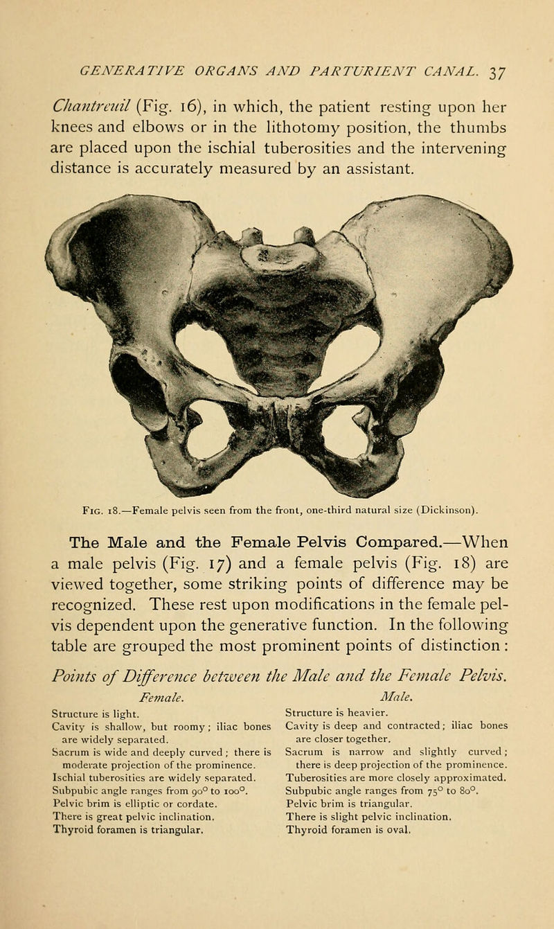 Chantreiiil (Fig. 16), in which, the patient resting upon her knees and elbows or in the hthotomy position, the thumbs are placed upon the ischial tuberosities and the intervening distance is accurately measured by an assistant. Fig. 18.—Female pelvis seen from the front, one-third natural size (Dickinson). The Male and the Female Pelvis Compared.—When a male pelvis (Fig. 17) and a female pelvis (Fig. 18) are viewed together, some striking points of difference may be recognized. These rest upon modifications in the female pel- vis dependent upon the generative function. In the following table are grouped the most prominent points of distinction: Points of Difference between the Male and the Female Pelvis. Female. Structure is light. Cavity is shallow, but roomy ; iliac bones are widely separated. Sacrum is wide and deeply curved ; there is moderate projection of the prominence. Ischial tuberosities are widely separated. Subpubic angle ranges from 90° to 100°. Pelvic brim is elliptic or cordate. There is great pelvic inclination. Thyroid foramen is triangular. Male. Structure is heavier. Cavity is deep and contracted; iliac bones are closer together. Sacrum is narrow and slightly curved ; there is deep projection of the prominence. Tuberosities are more closely approximated. Subpubic angle ranges from 75° to 80°. Pelvic brim is triangular. There is slight pelvic inclination. Thyroid foramen is oval.