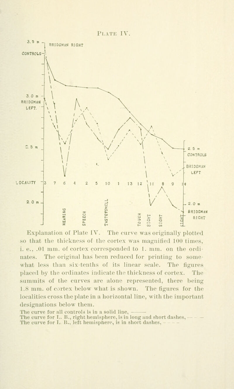 Plate IV. 3. 5 b -. CONTROLS-^ 3. 0 m 8RIDGMAN LEFT. BRIDGMAN RIGHT Z. 5 m LOCALITr - 2. 0 m _ M 'AN \i * \ \ / \ V \ V \ 3 7 6 4 2 5 10 1 13 12 ' 11 8 9 l|* A n t-> f- re X ^ a o o (- CO C/I BRIDGMAN LEPT BRIDGMAN RIGHT Explanation of Plate IV. The curve was originally plotted so that the thickness of the cortex was magnified 100 times, i. e., .01 mm. of cortex corresponded to 1. mm. on the ordi- nates. The original has been reduced for printing to some- what less than six-tenths of its linear scale. The figures placed by the ordinates indicate the thickness of cortex. The summits of the curves are alone represented, there being 1.8 mm. of cortex below what is shown. The figures for the localities cross the plate in a horizontal line, with the important designations below them. The curve for all controls is in a solid line, The curve for L. B., right hemisphere, is in long and short dashes, — The curve for L B., left hemisphere, is in short dashes, -