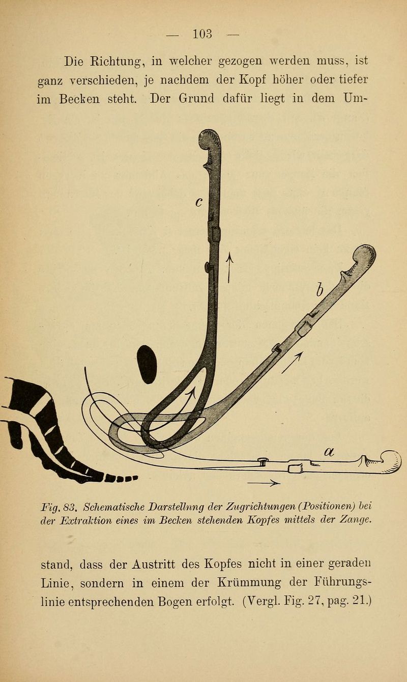 Die Kichtuüg, in welcher gezogen werden muss, ist ganz verschieden, je nachdem der Kopf höher oder tiefer im Becken steht. Der Grund dafür liegt in dem Um- Fig. 83. Schematische DarsteUnng der ZugricMungen (Positionen) hei der Extraktion eines im Becken stehenden Kopfes mittels der Zange. stand, dass der Austritt des Kopfes nicht in einer geraden Linie, sondern in einem der Krümmung der Führungs- linie entsprechenden Bogen erfolgt. (Vergl. Fig. 27, pag. 21.)