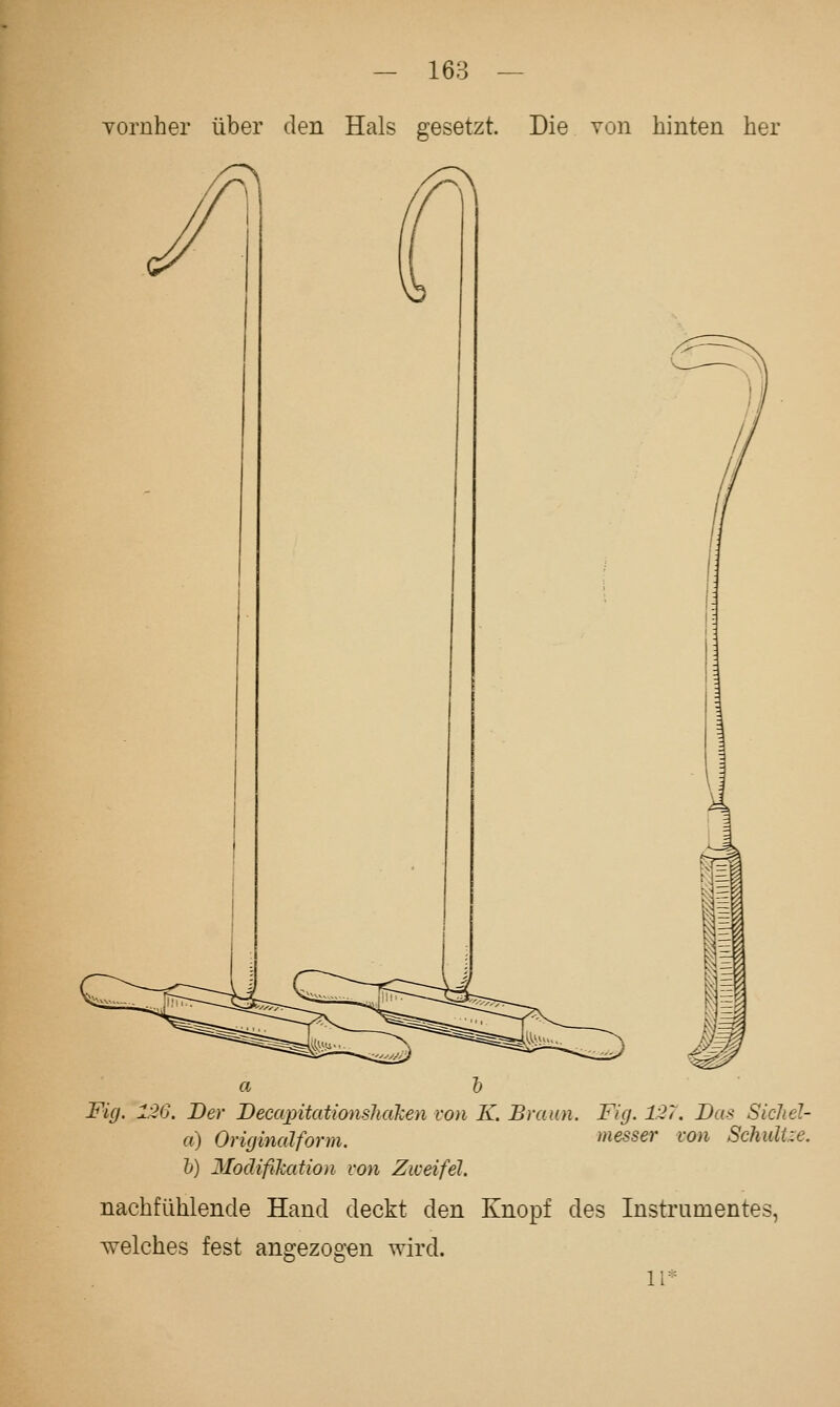 Yornher über den Hals gesetzt. Die von hinten her a h Fig. 1^6. Der DeccqntathnshaJcen von K. Braun. Fig. 127. Das Sichel- et) Origincäform. messer von Schultze. h) Modißlcation von Zweifel. nachfühlende Hand deckt den Knopf des Instrumentes, welches fest angezogen wird. 11*